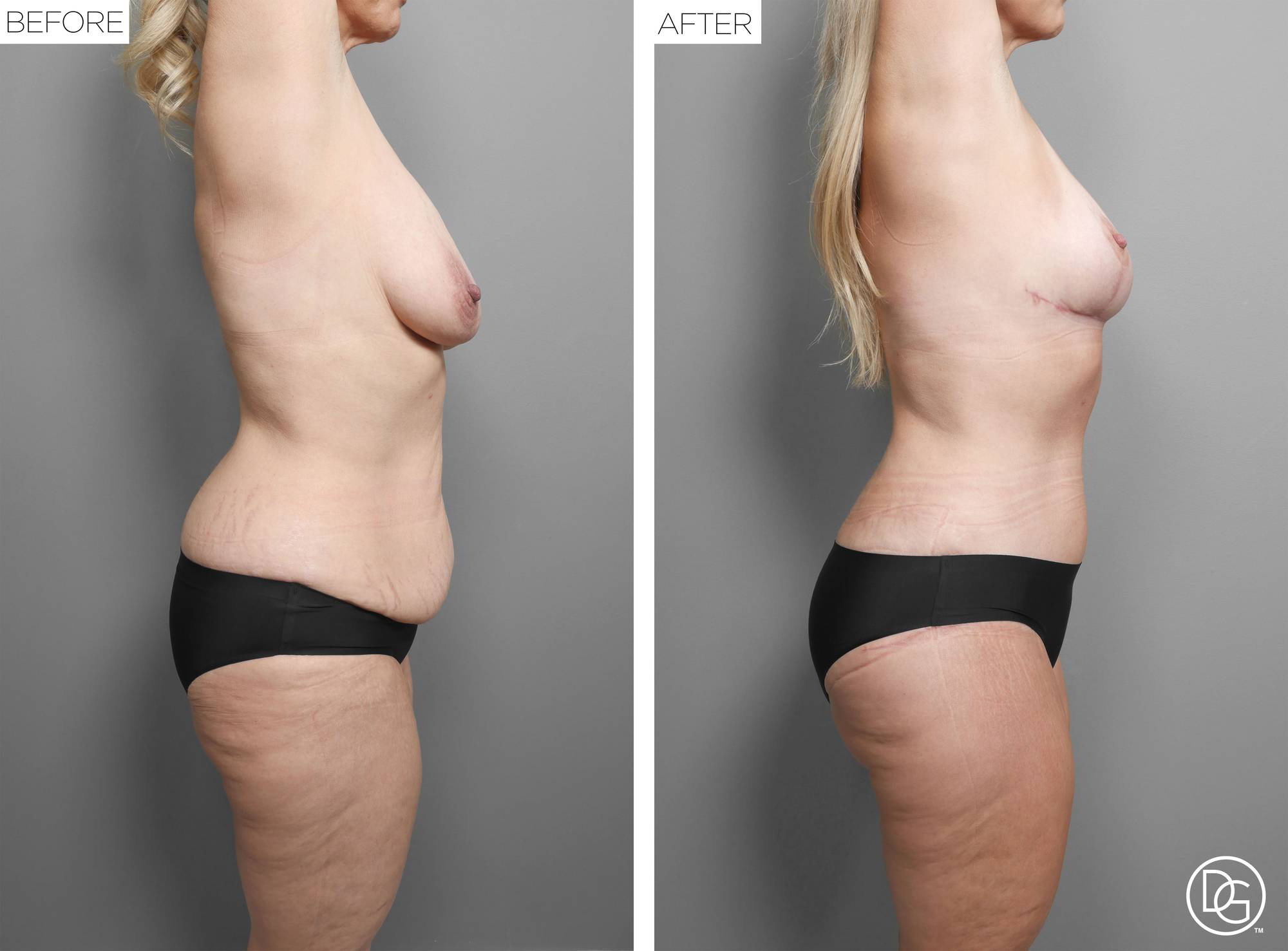 Before & After Image
