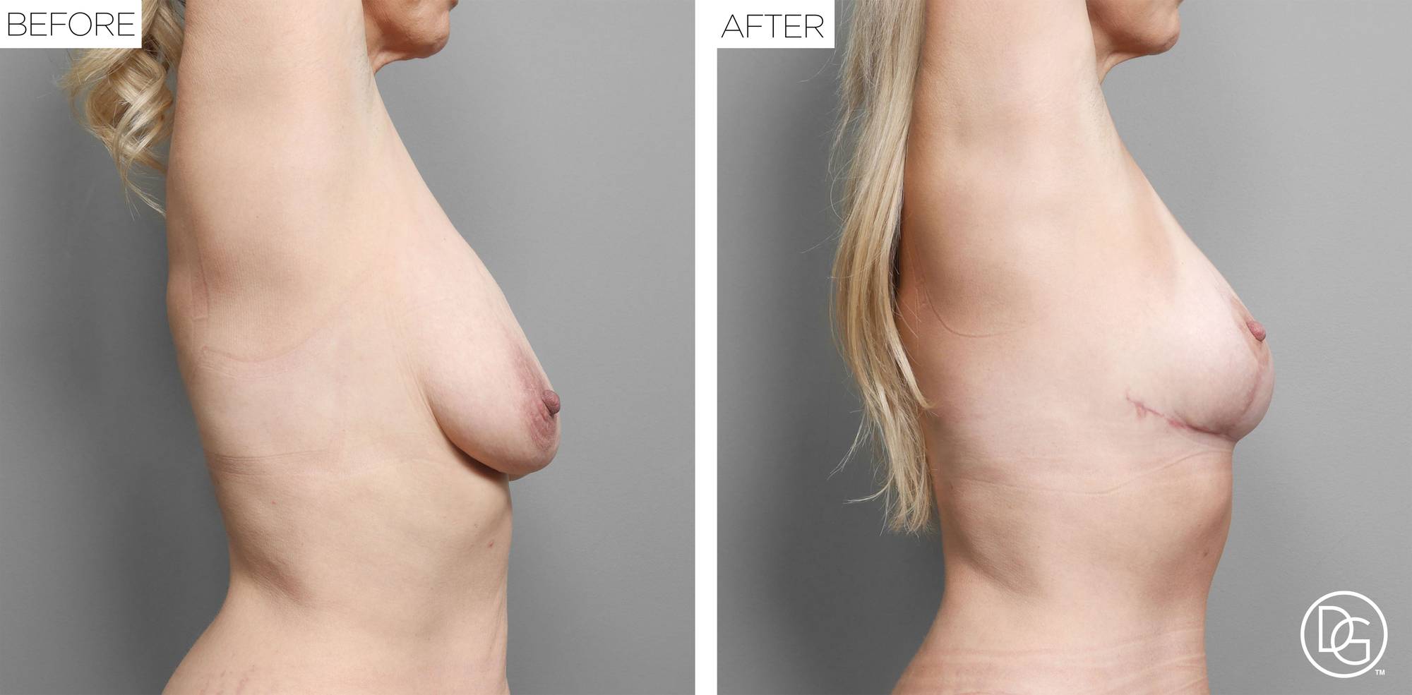Before & After Image