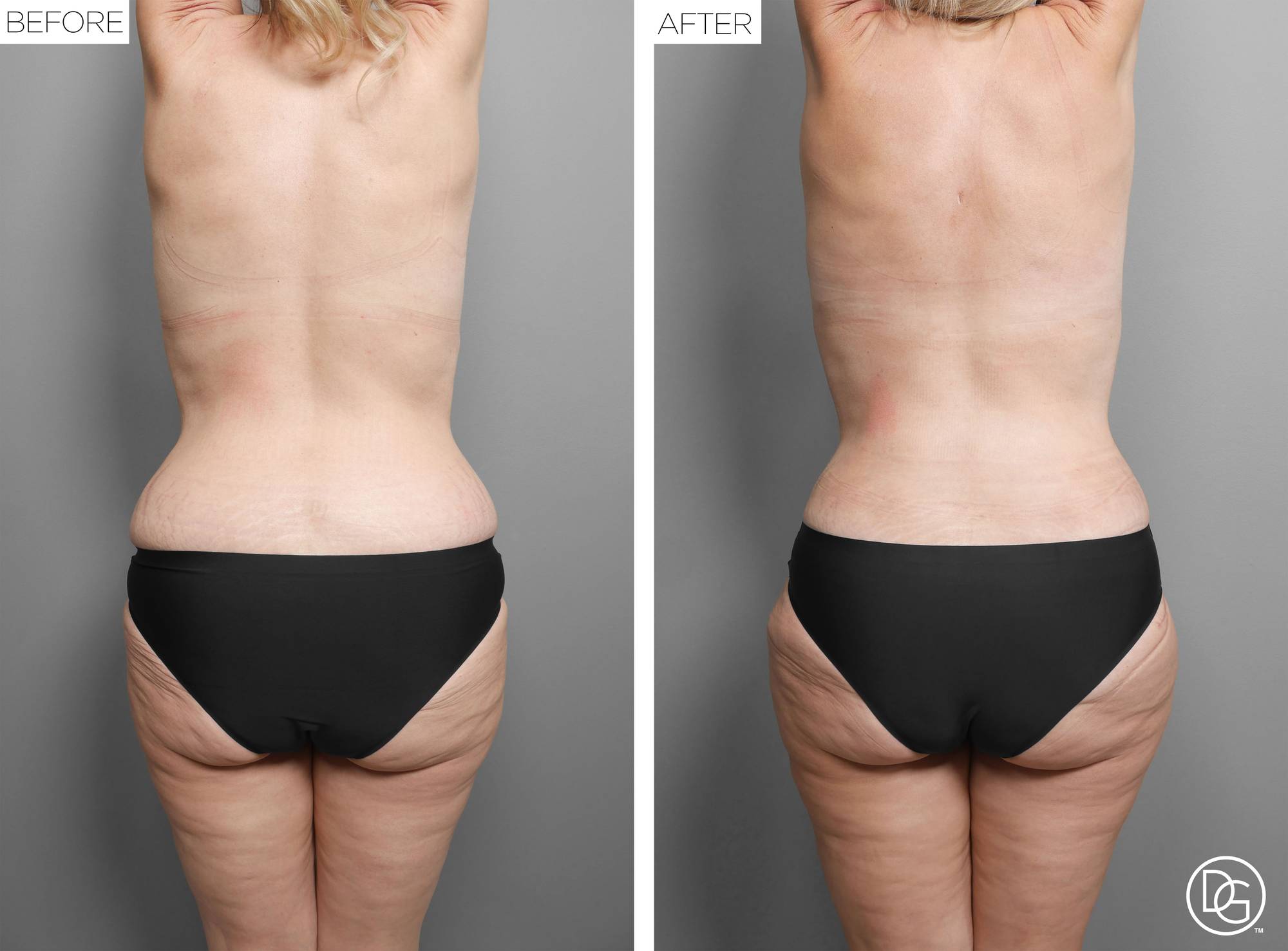 Before & After Image