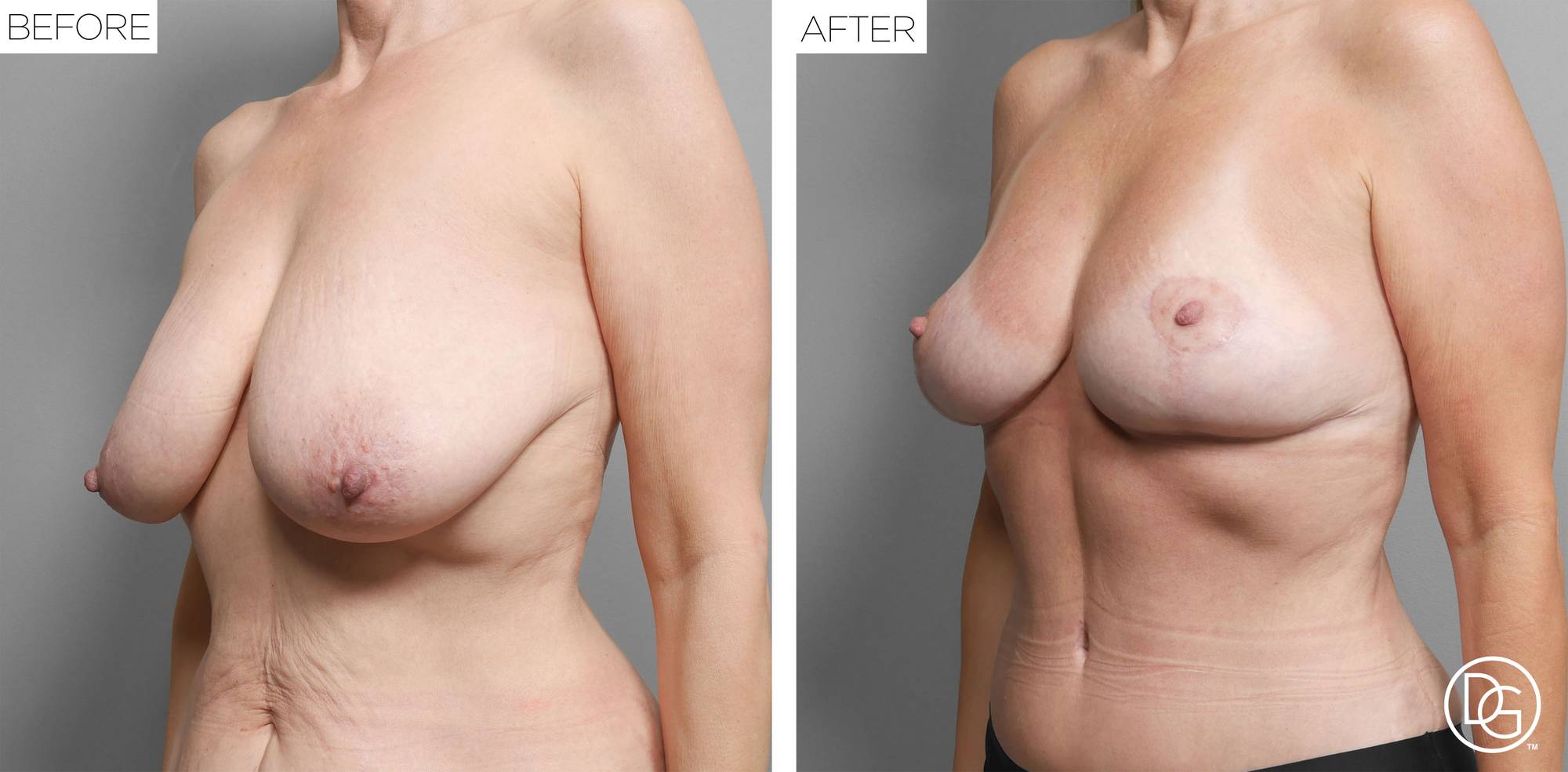 Before & After Image