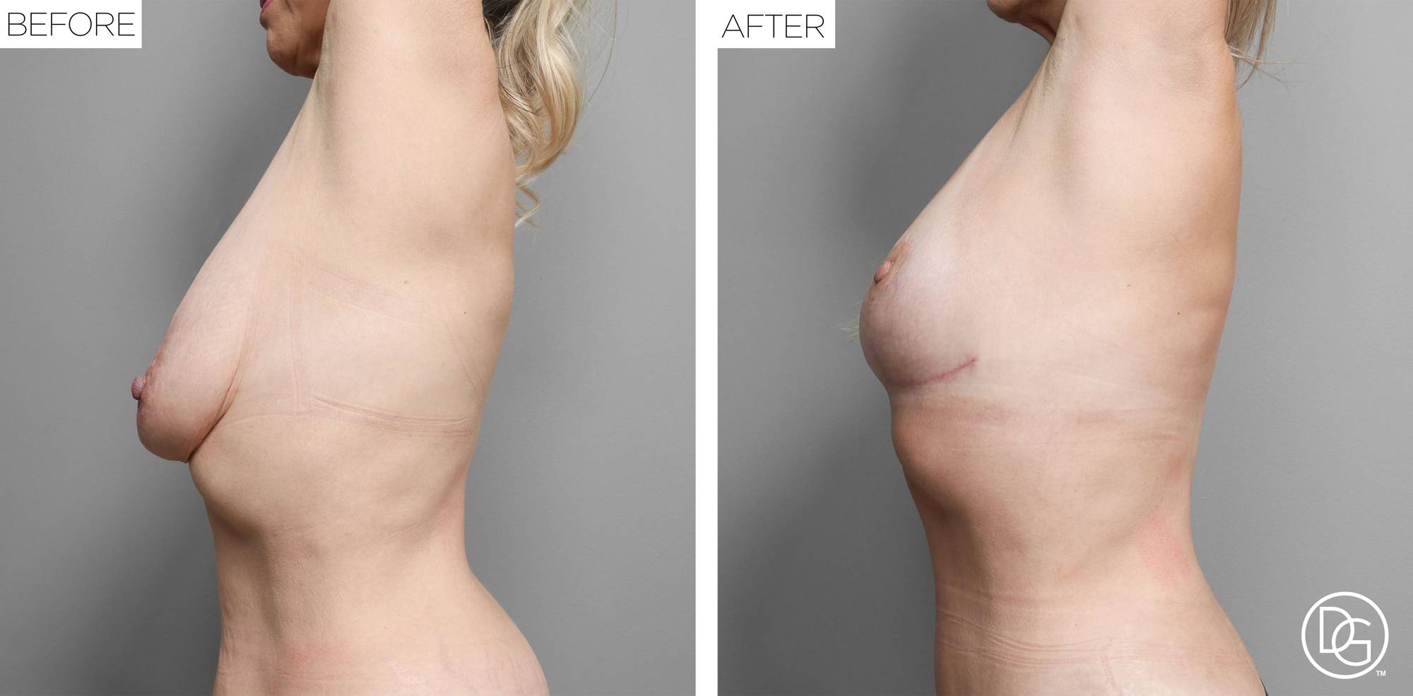 Before & After Image