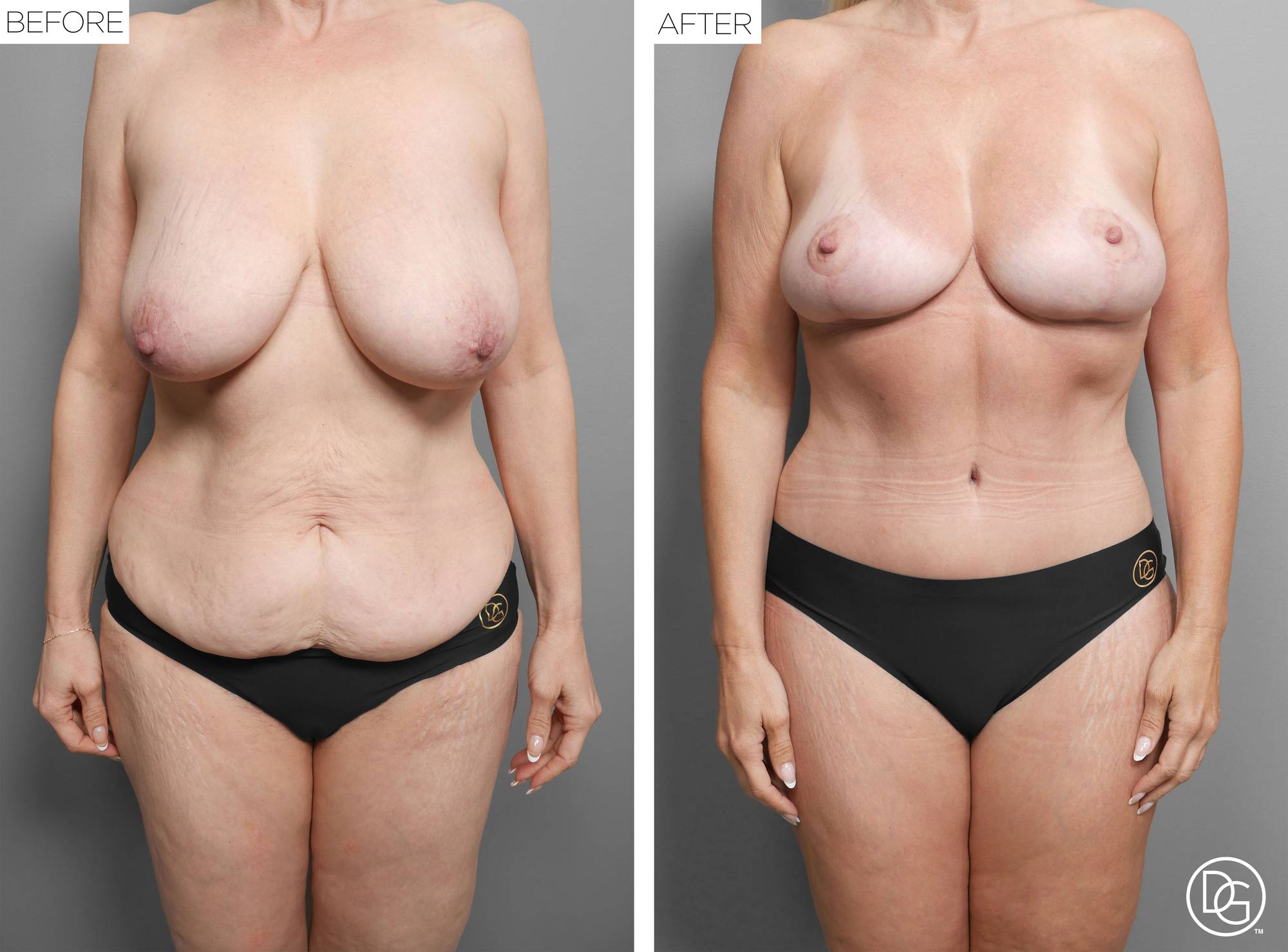 Before & After Image