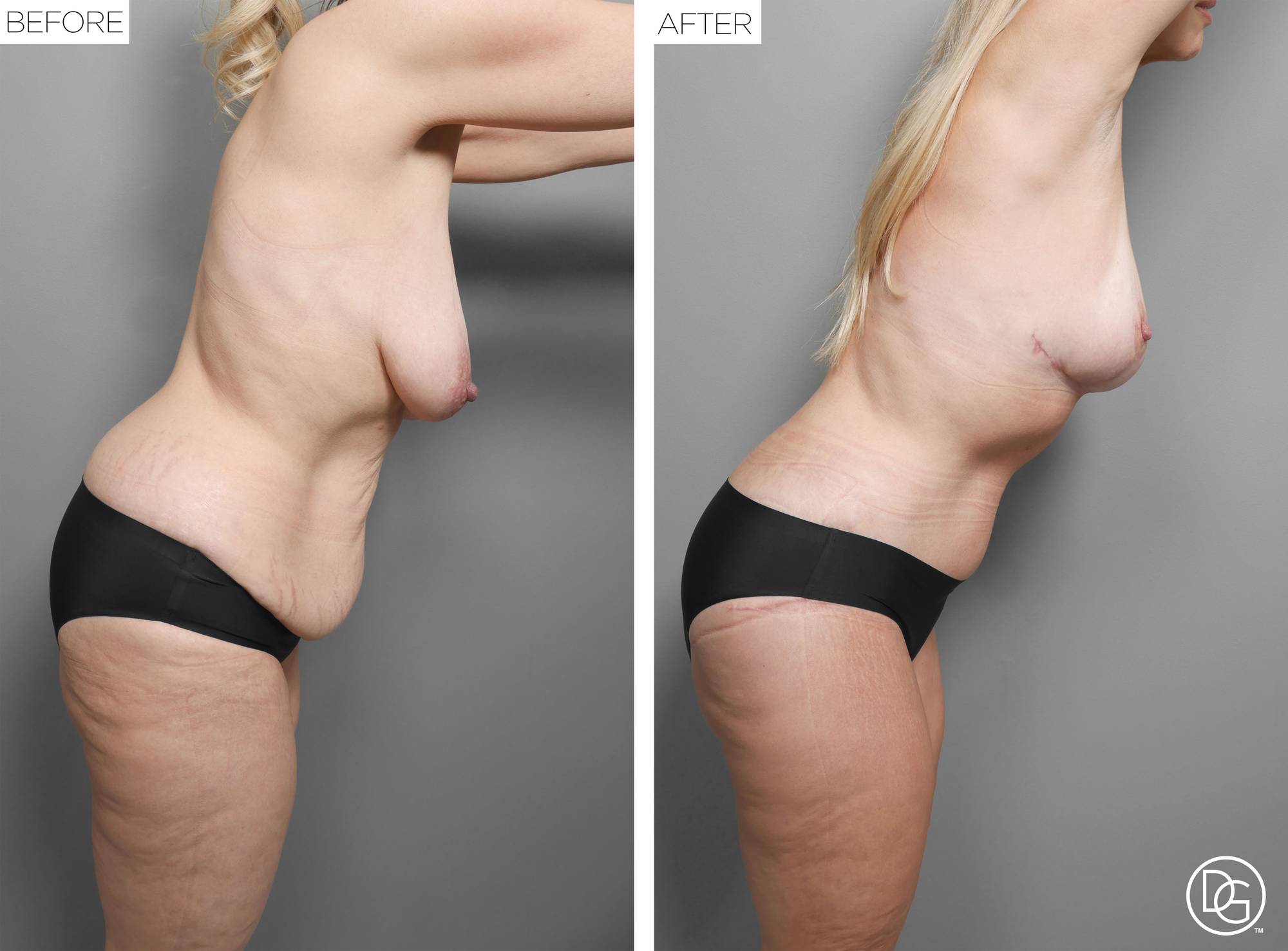 Before & After Image