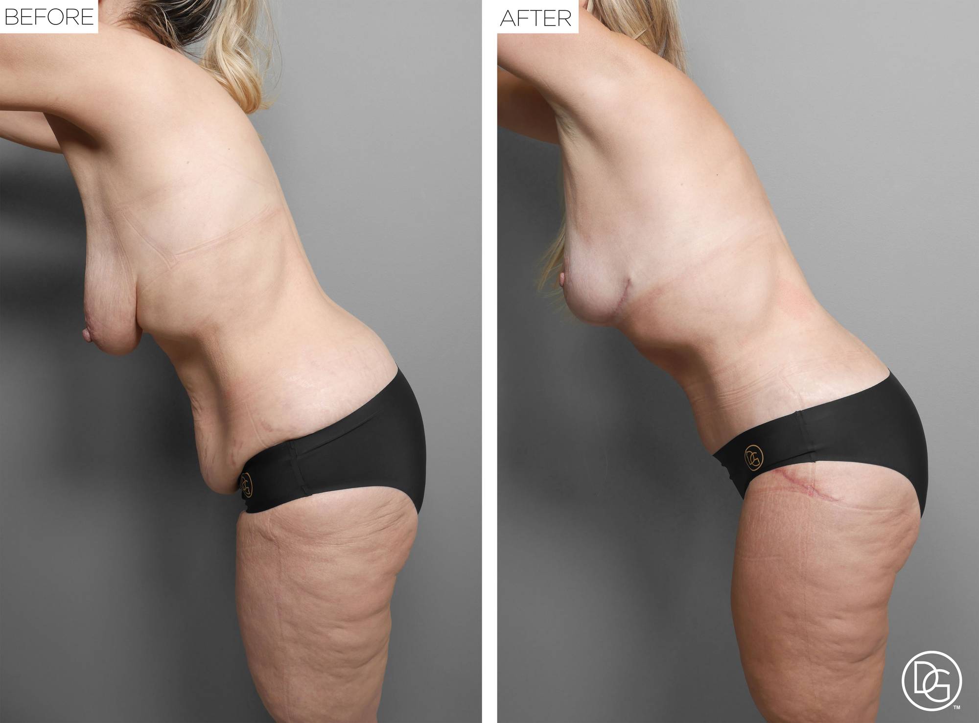 Before & After Image