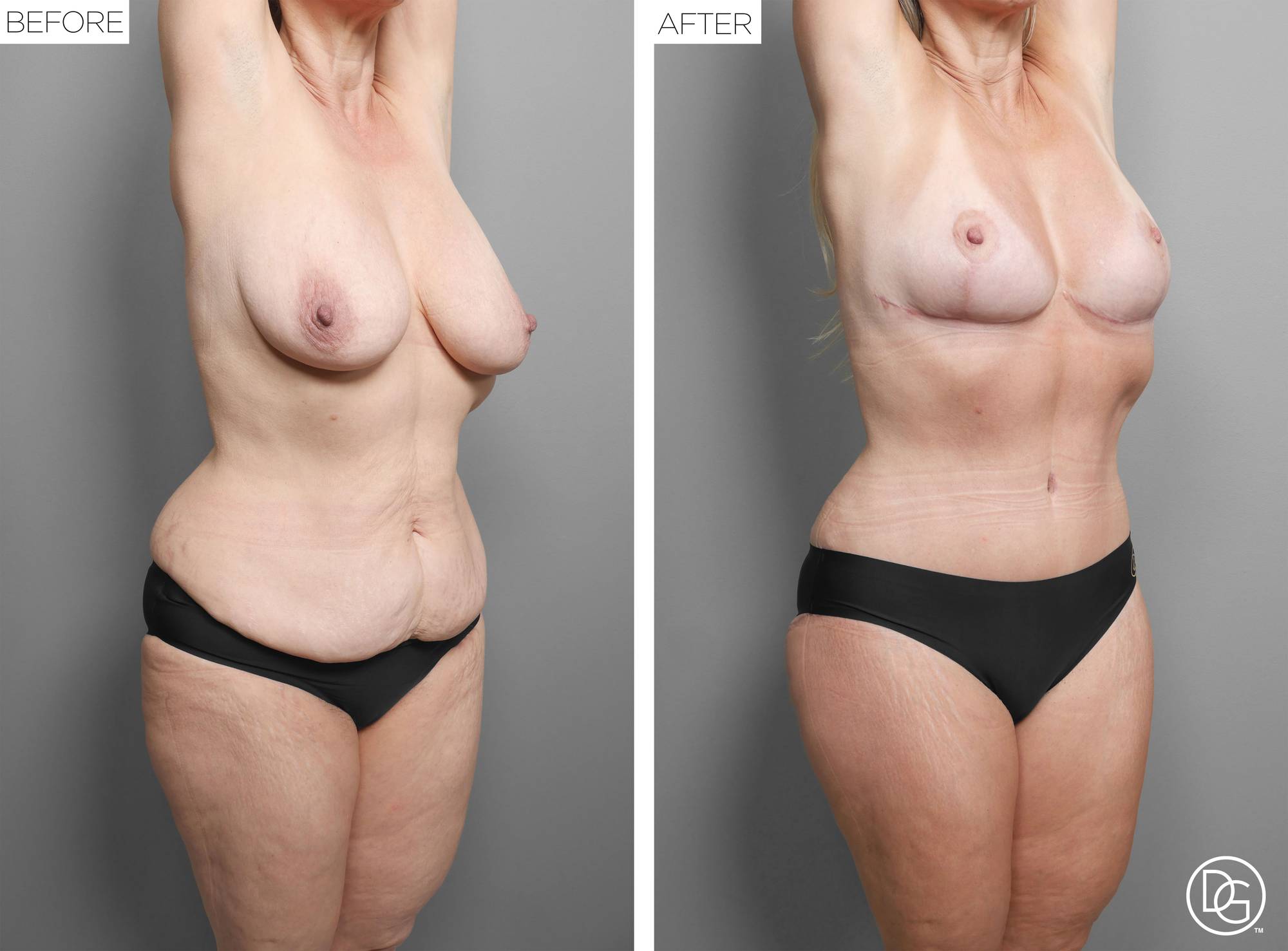 Before & After Image