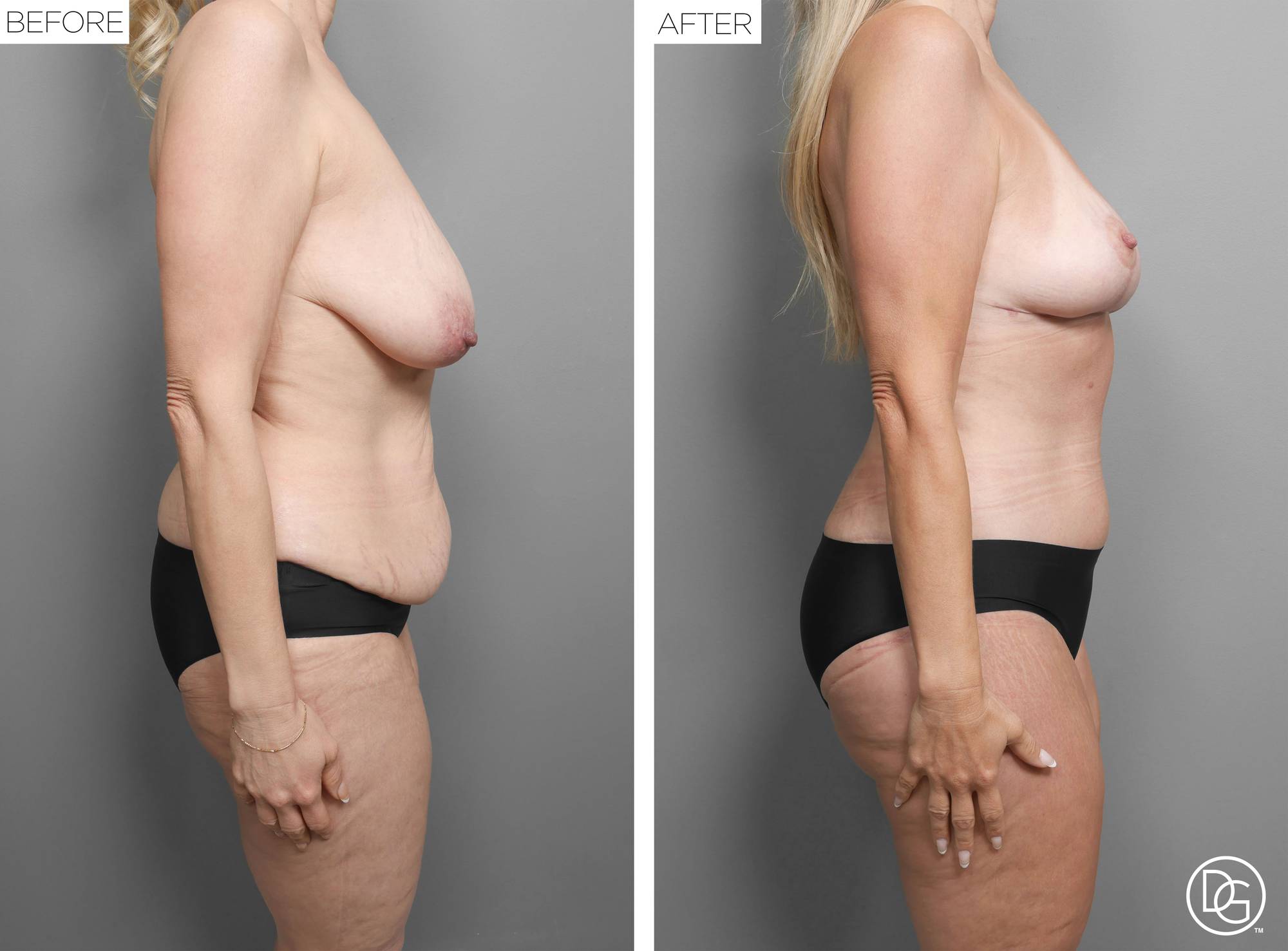 Before & After Image