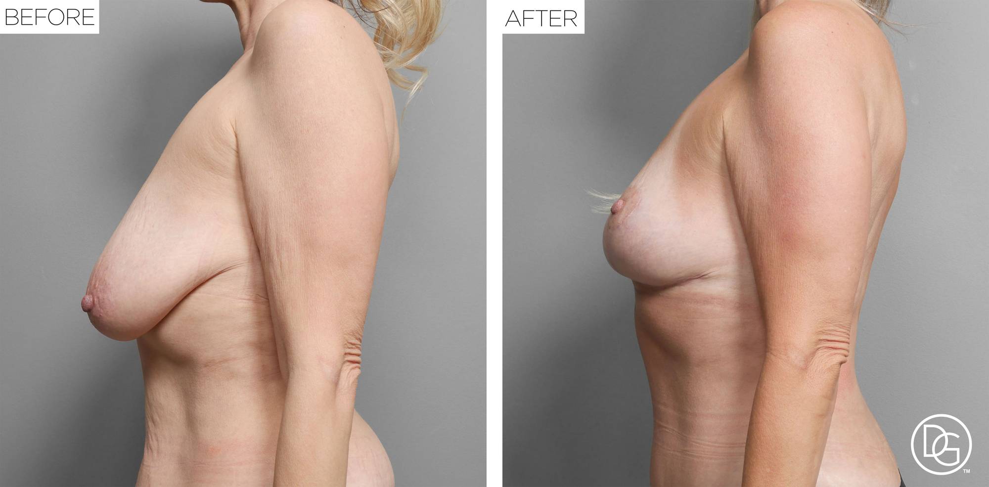 Before & After Image