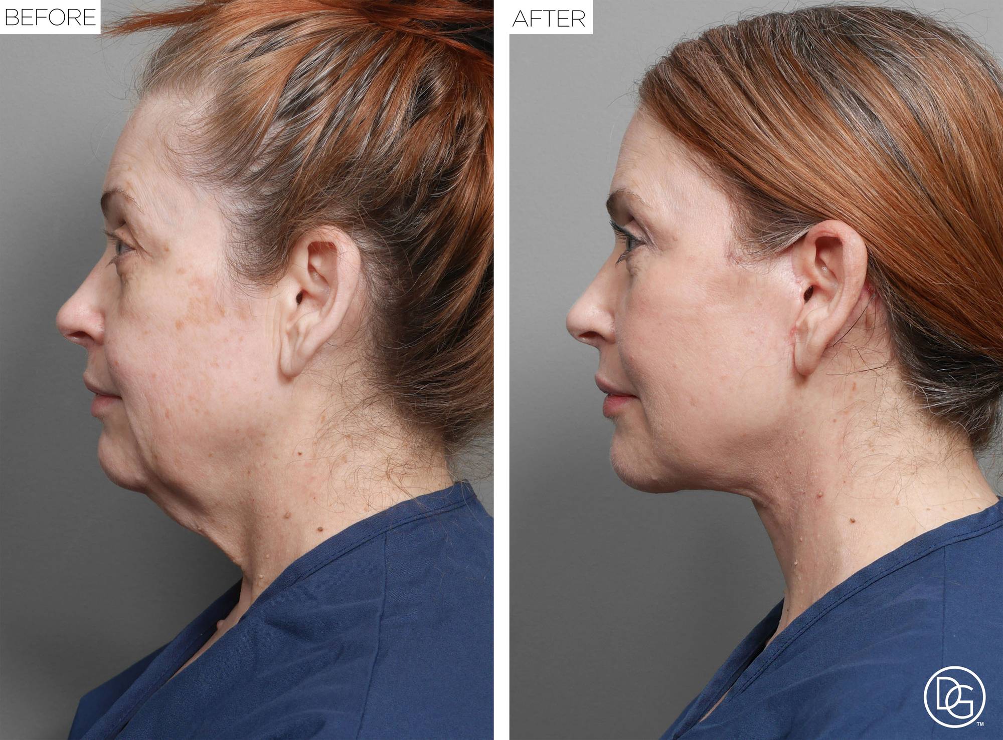 Before & After Image