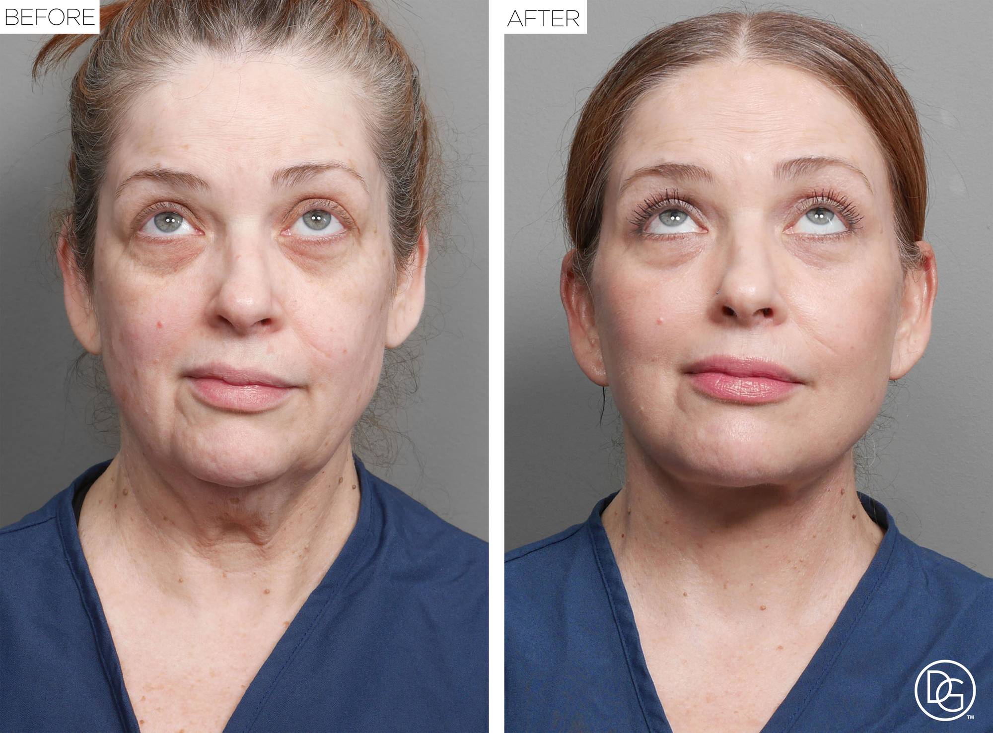 Before & After Image