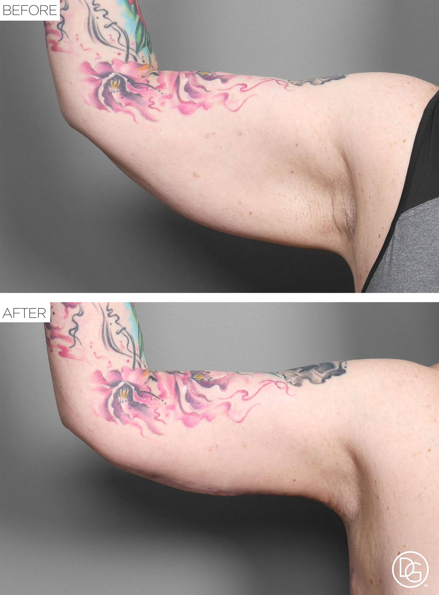 Before & After Image