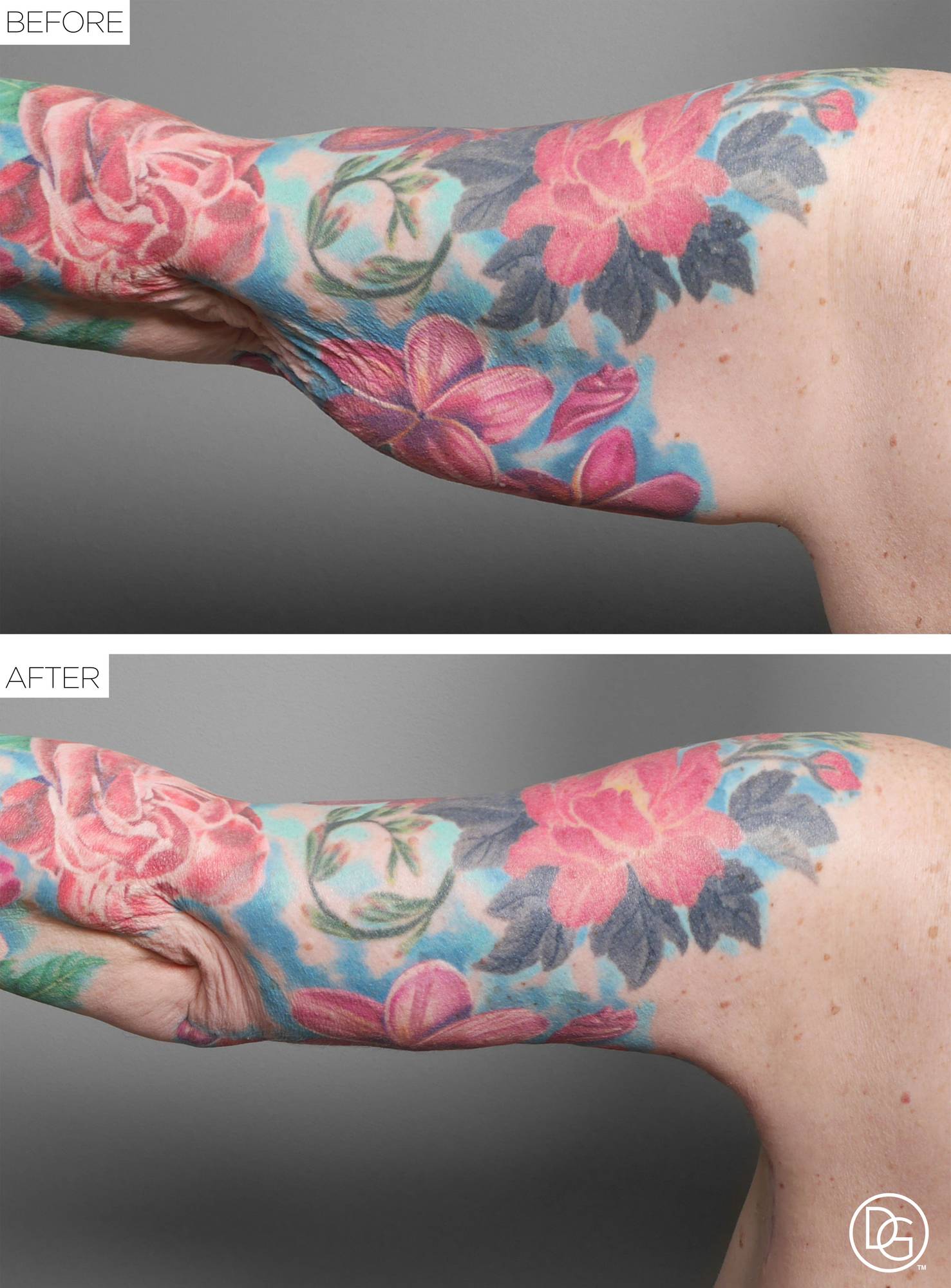Before & After Image