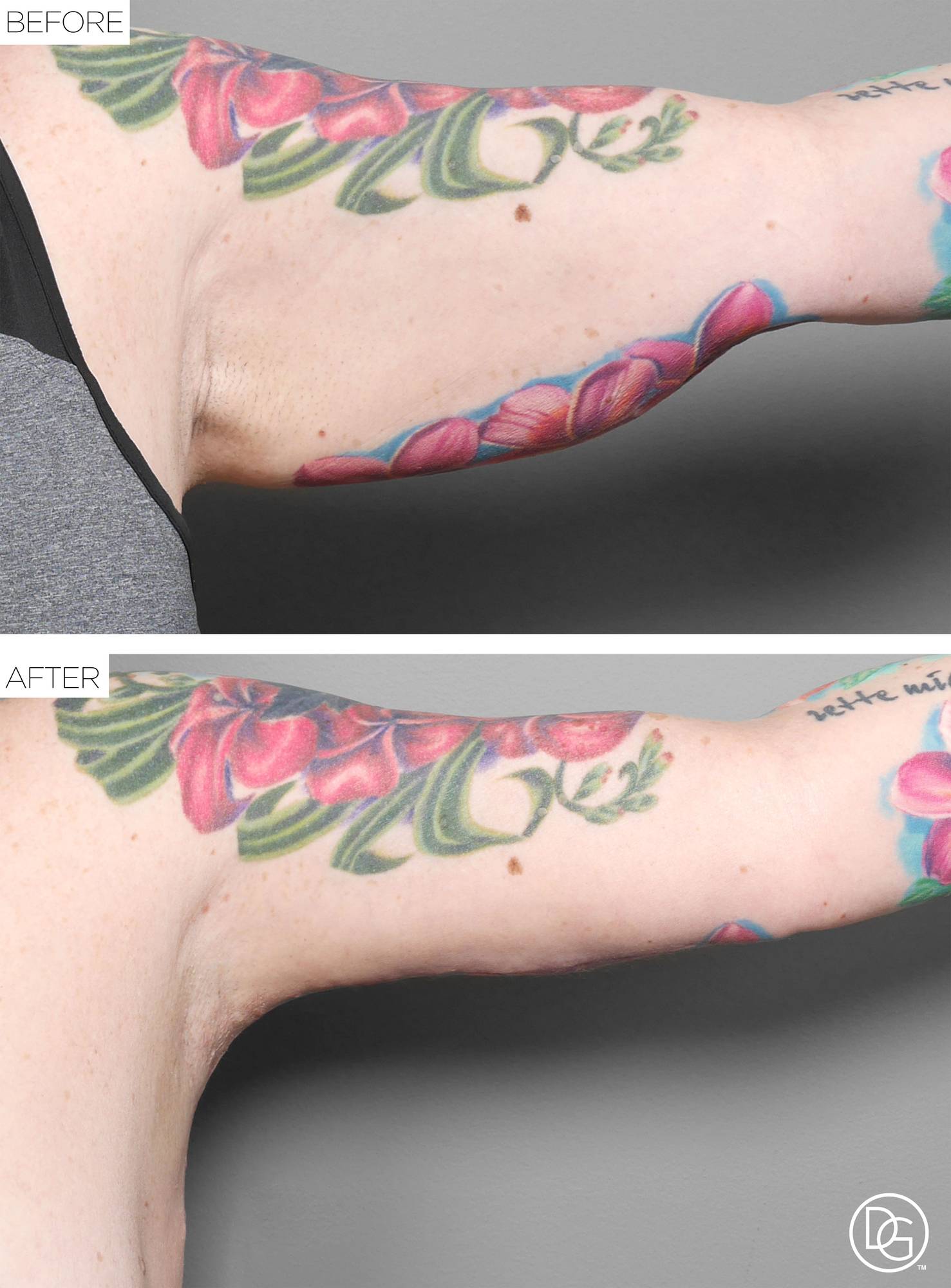 Before & After Image