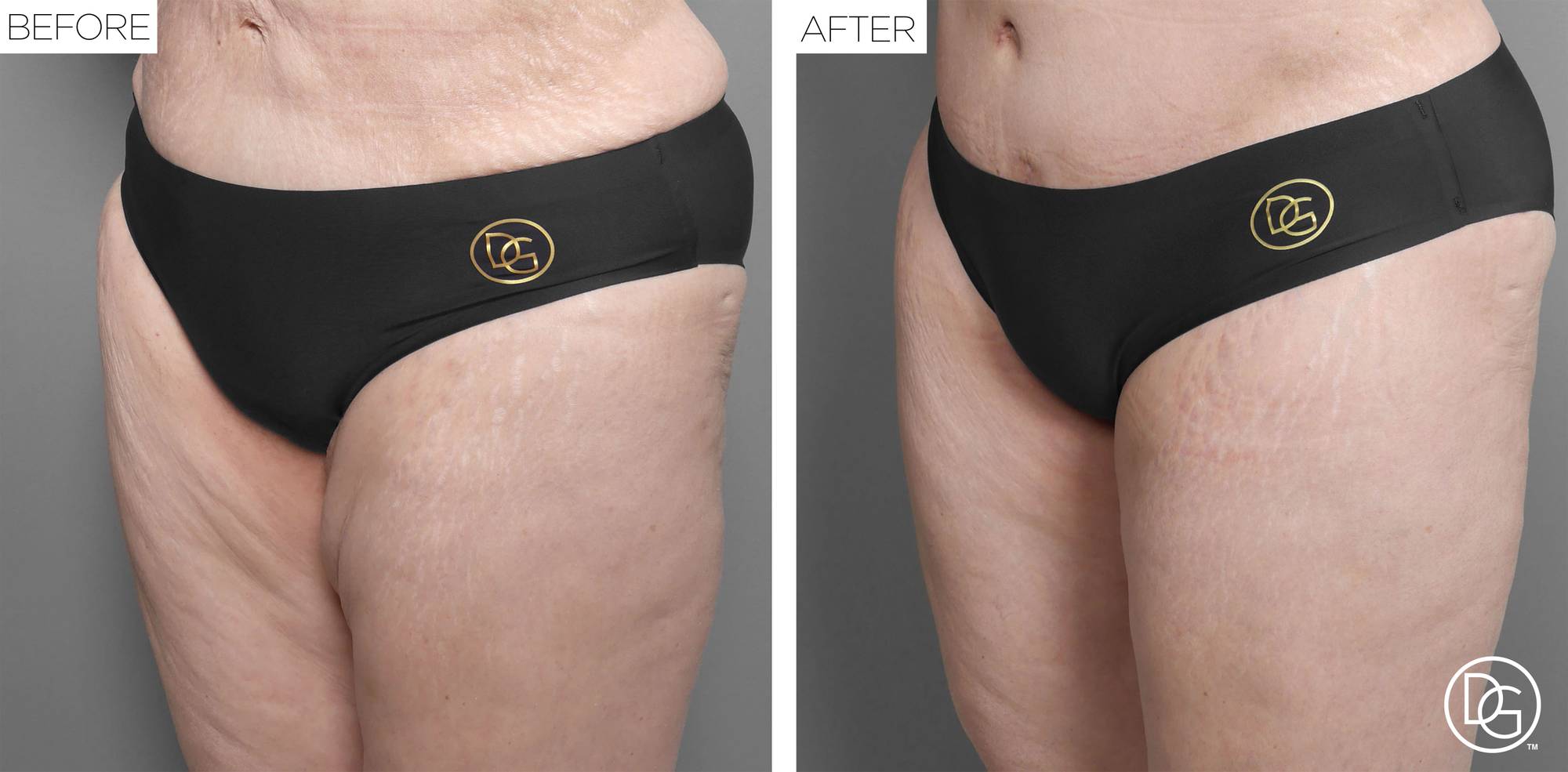 Before & After Image