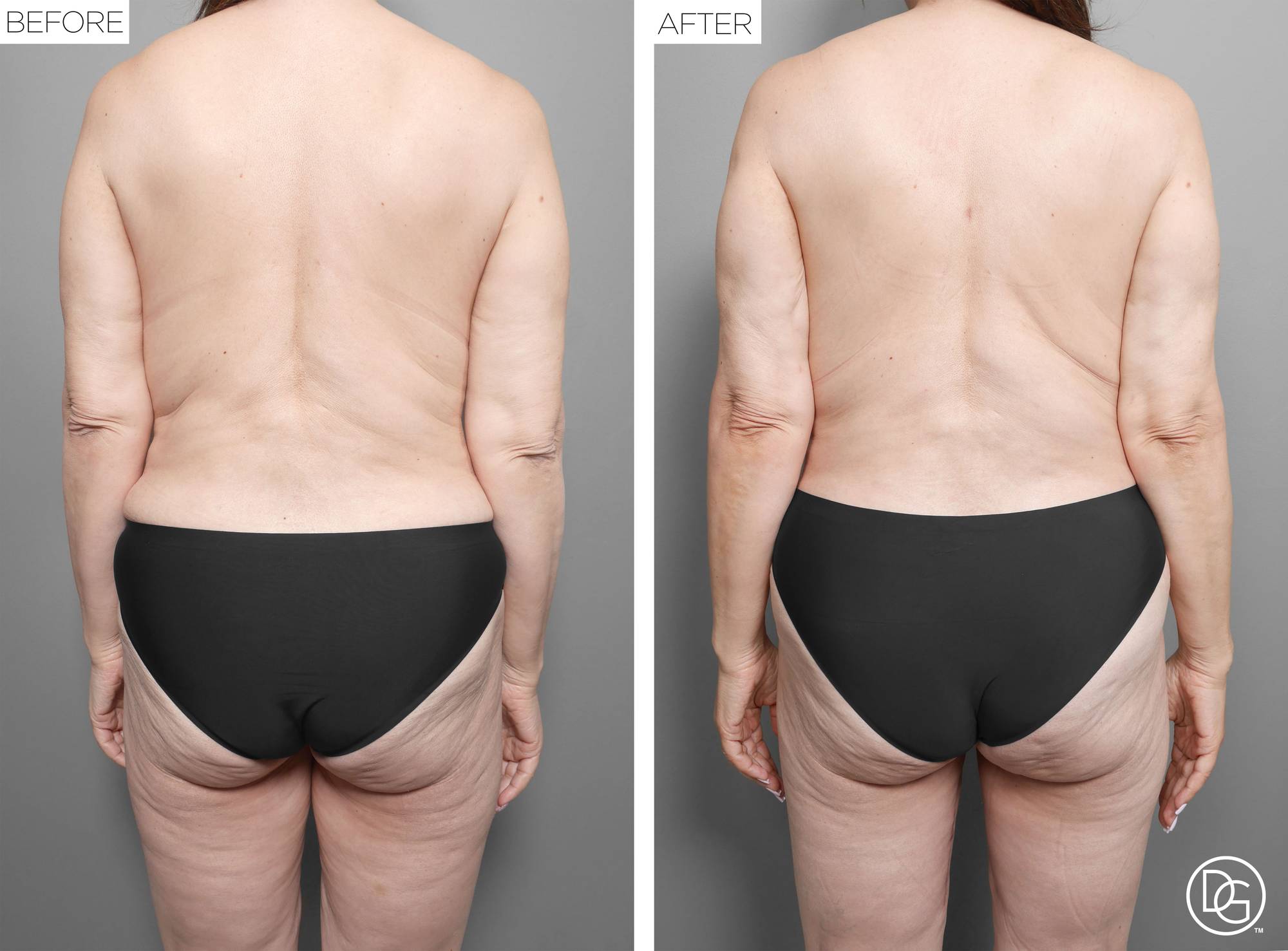 Before & After Image