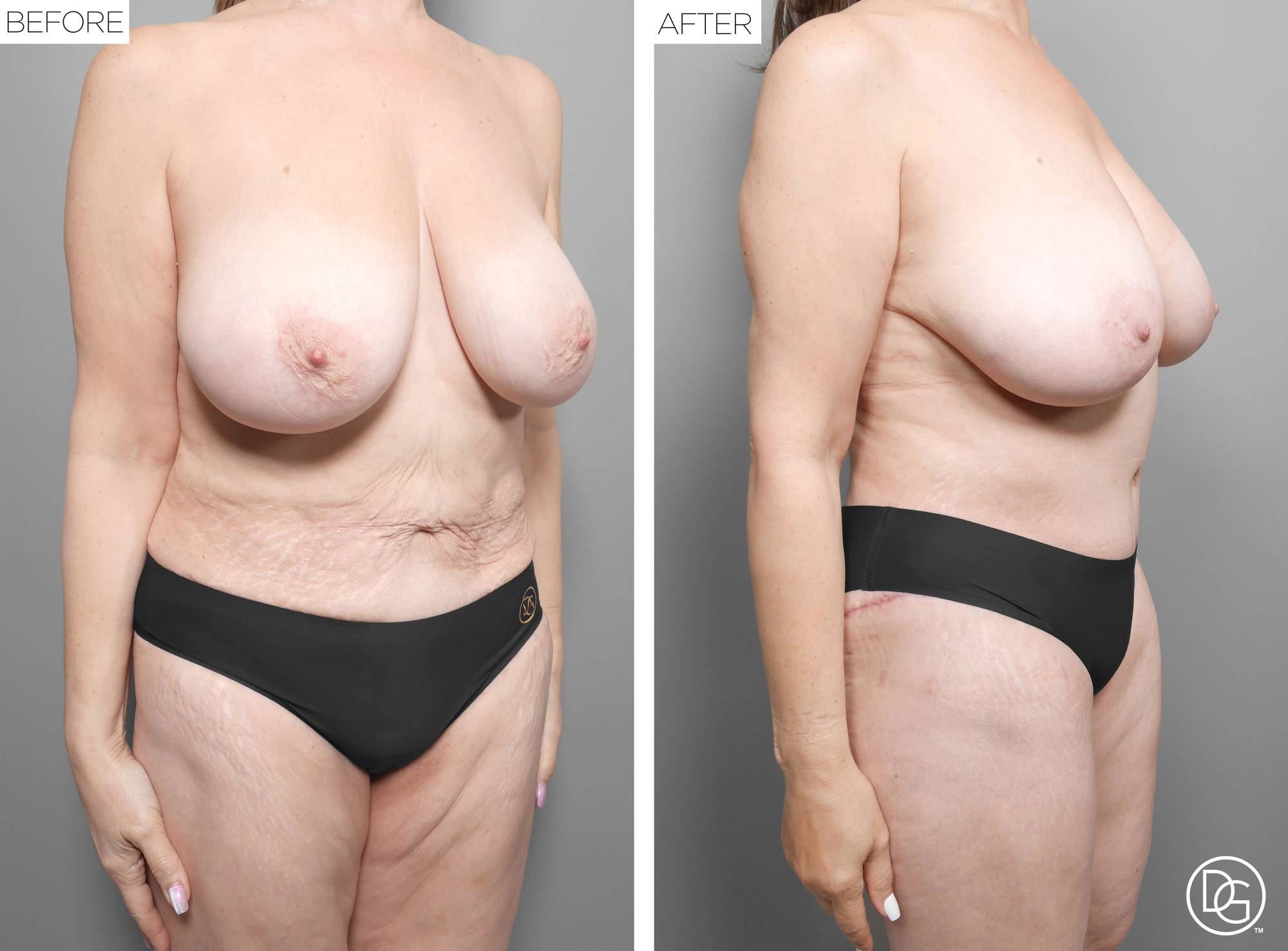 Before & After Image