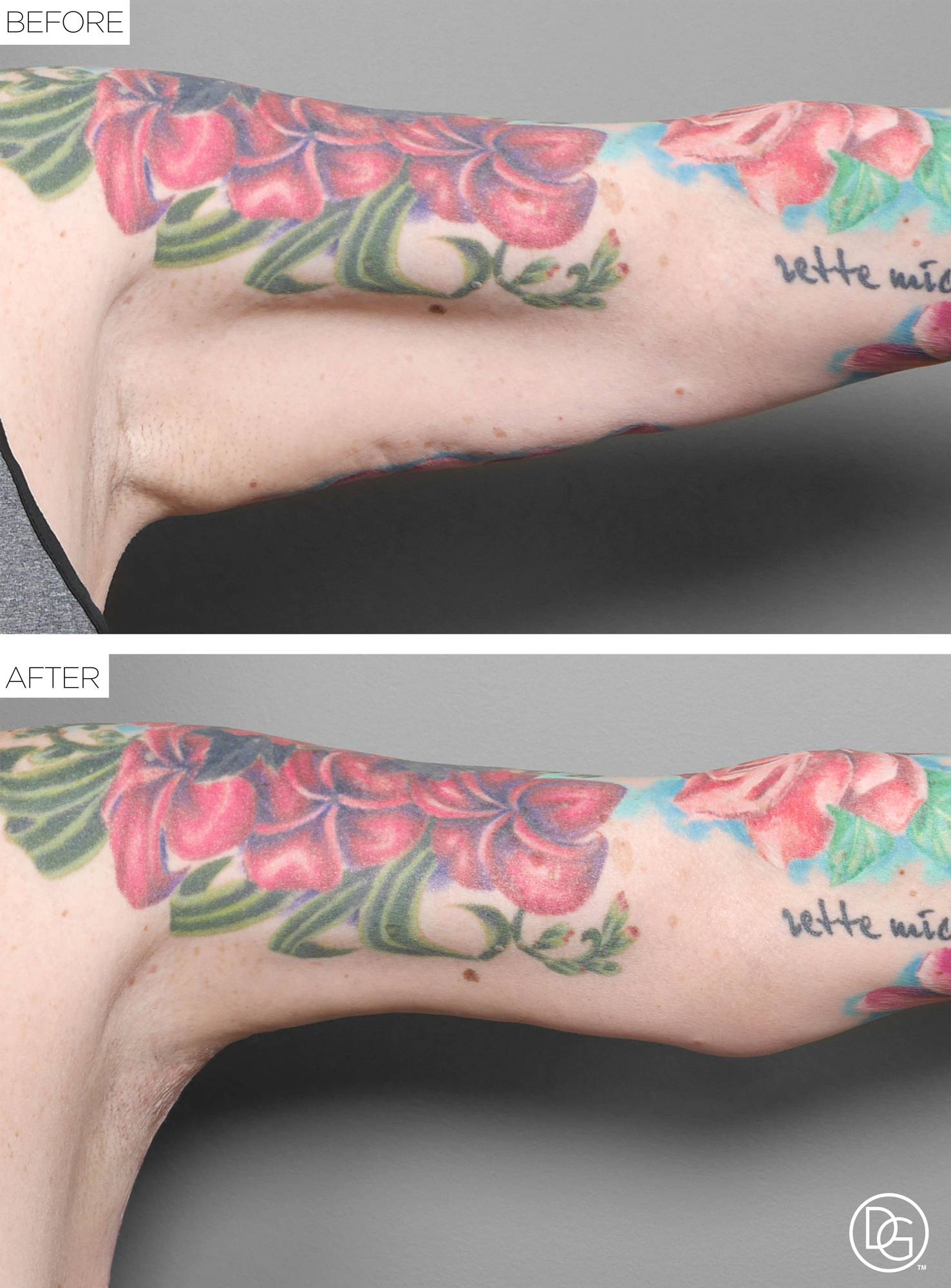 Before & After Image