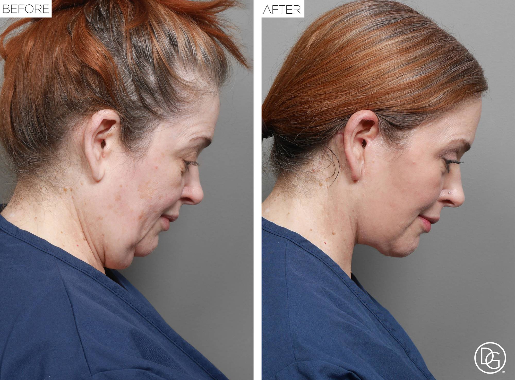 Before & After Image