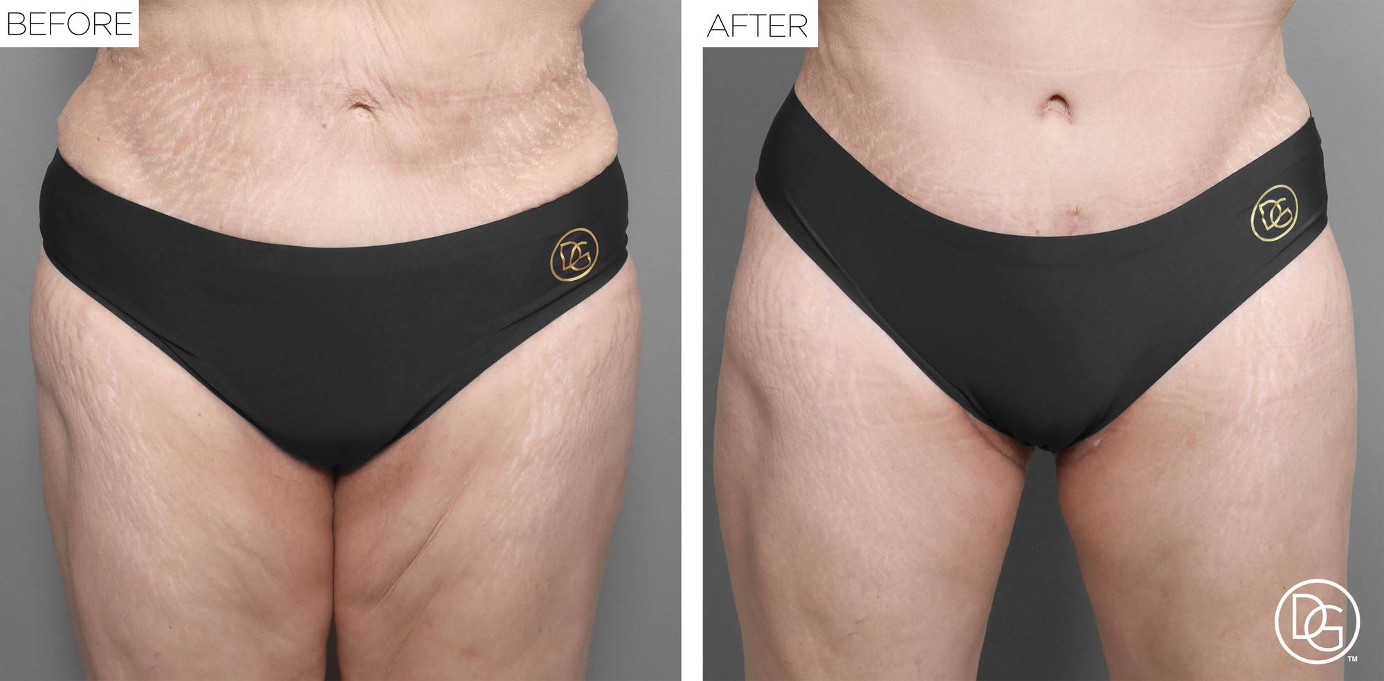 Before & After Image