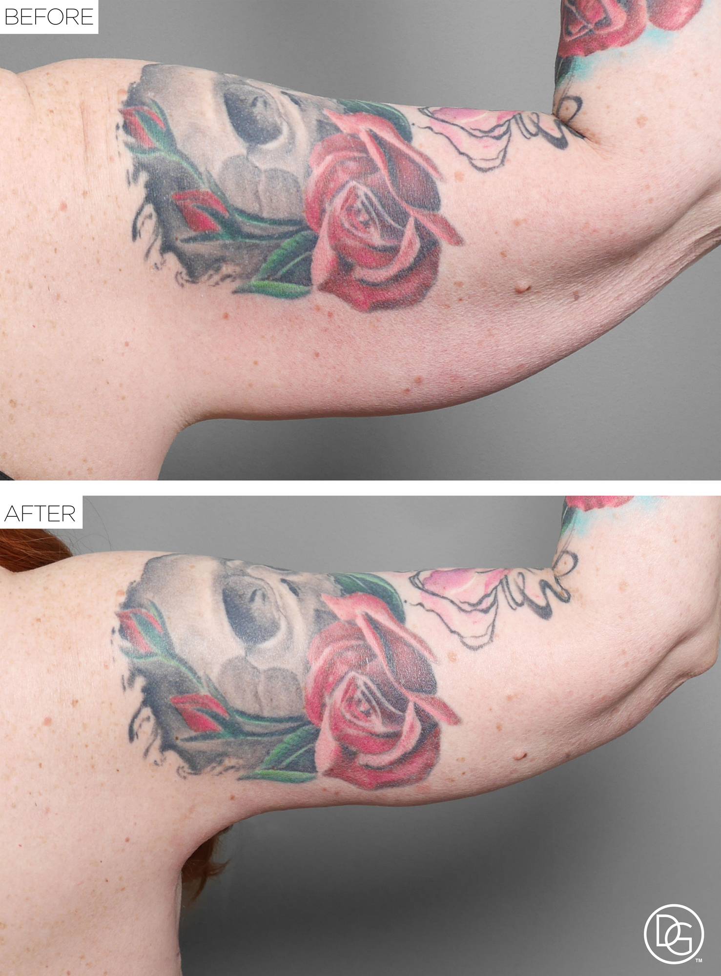 Before & After Image