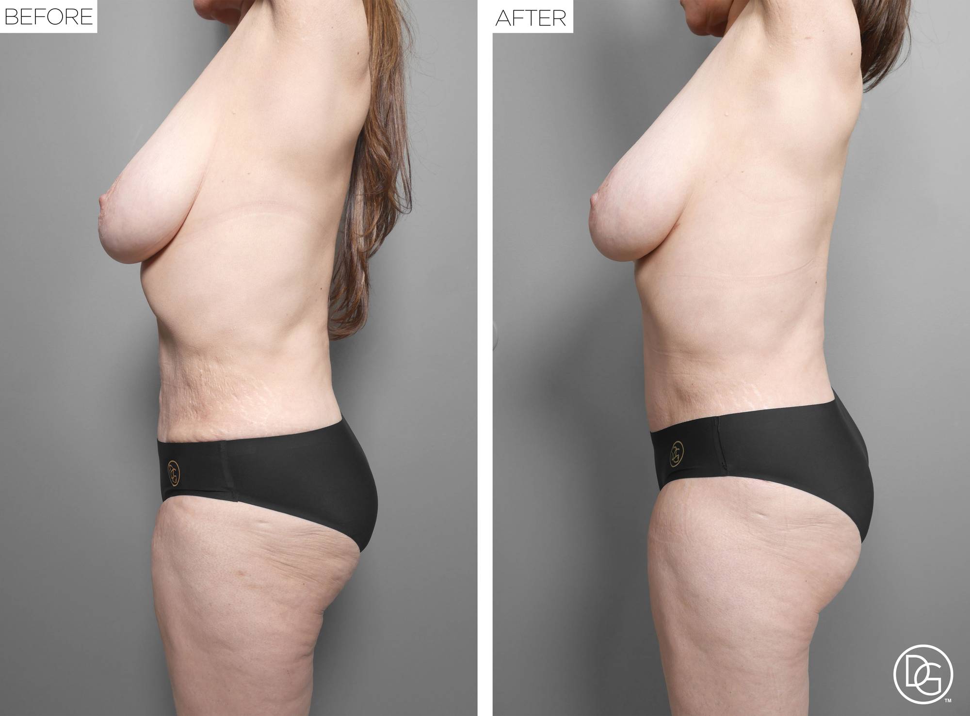 Before & After Image