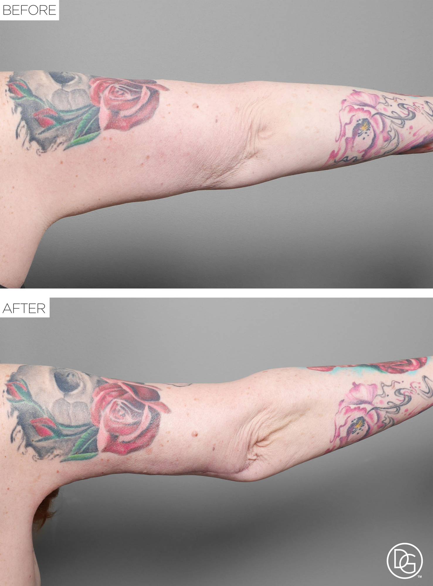 Before & After Image