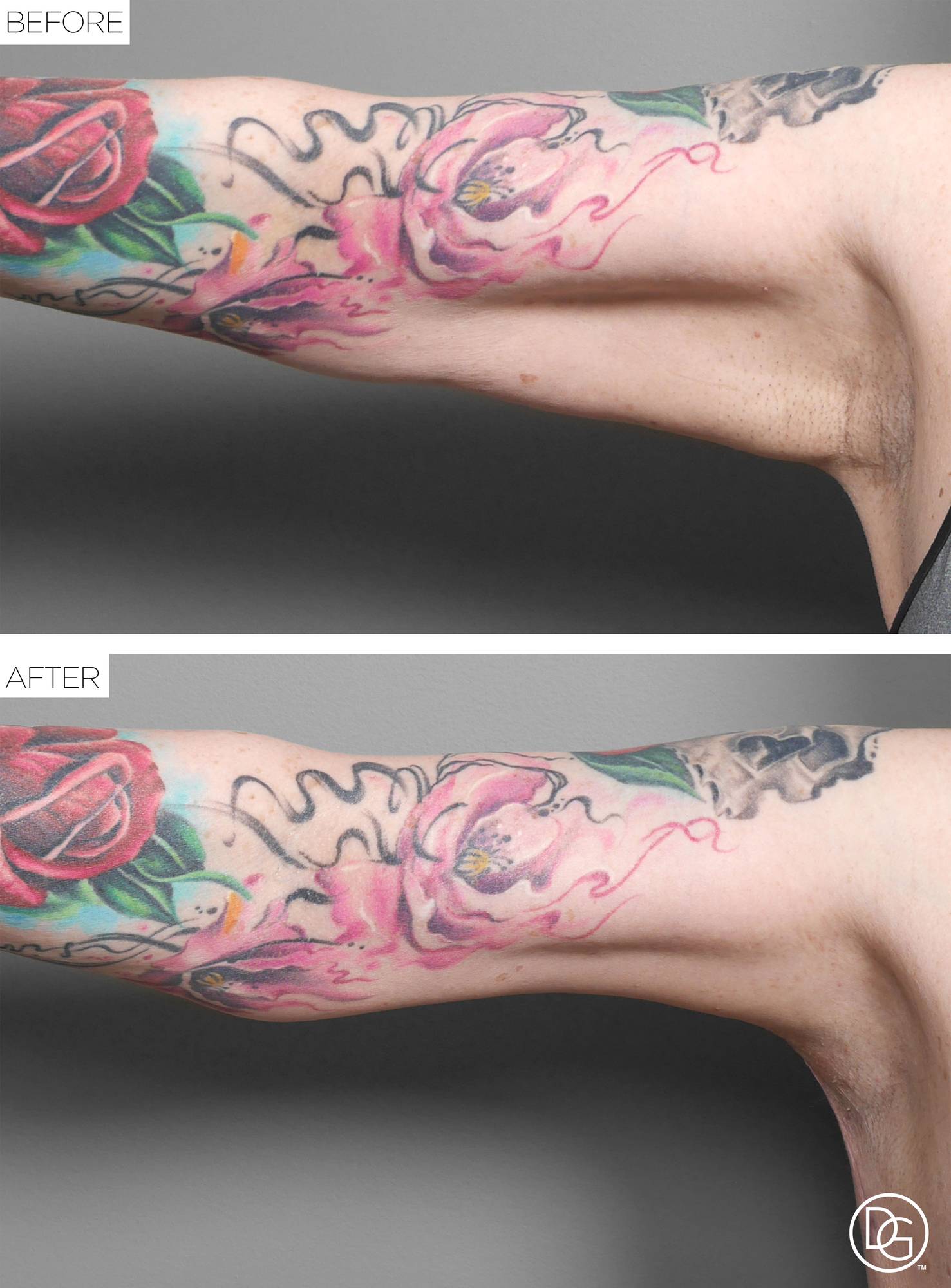 Before & After Image