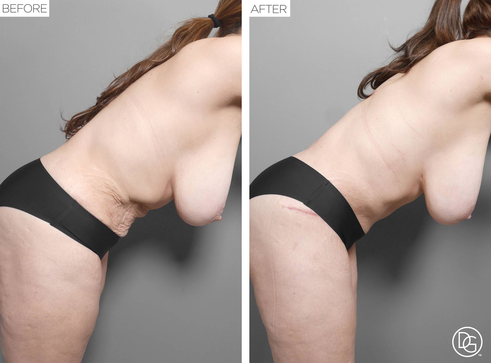Before & After Image