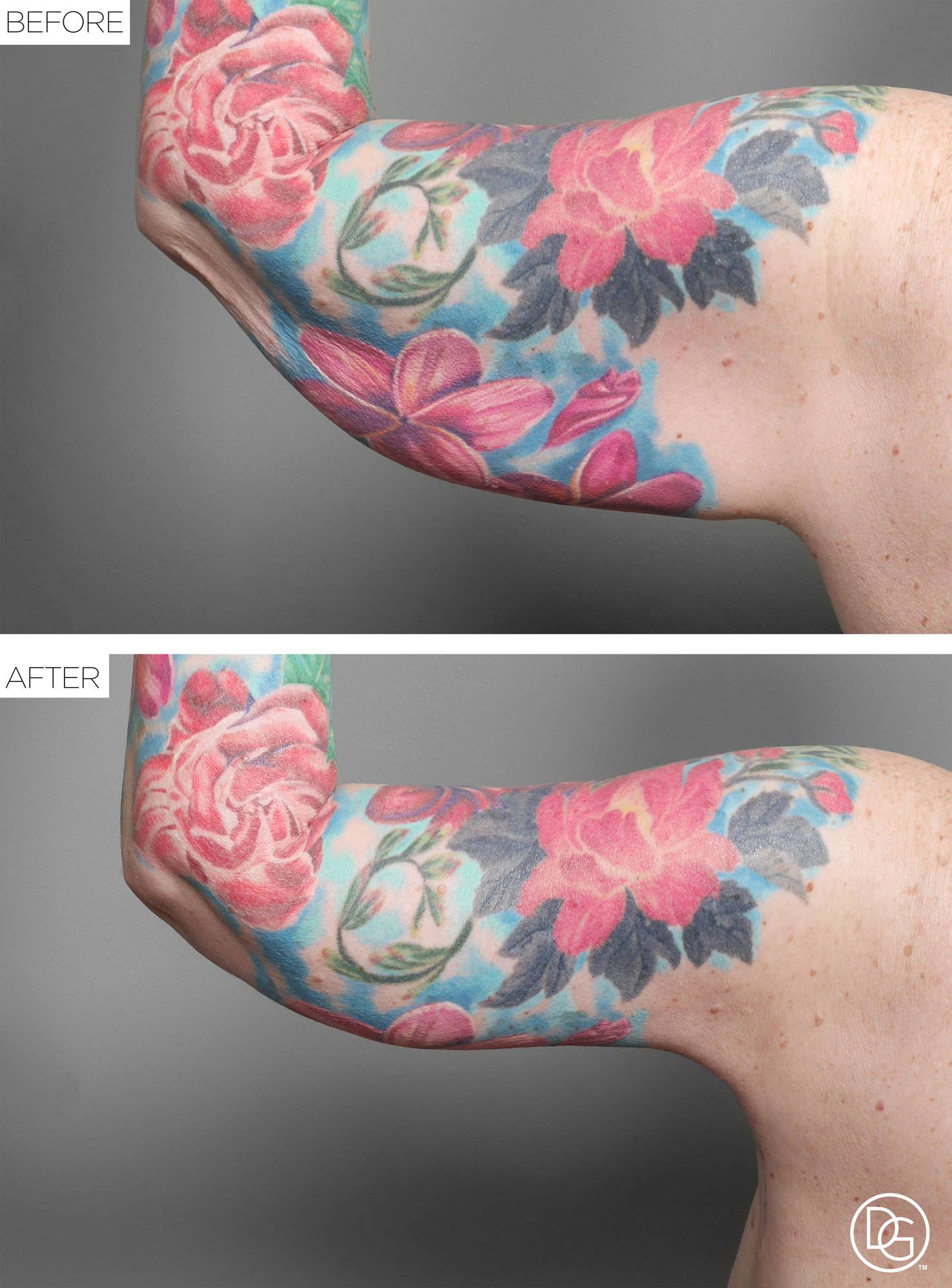 Before & After Image
