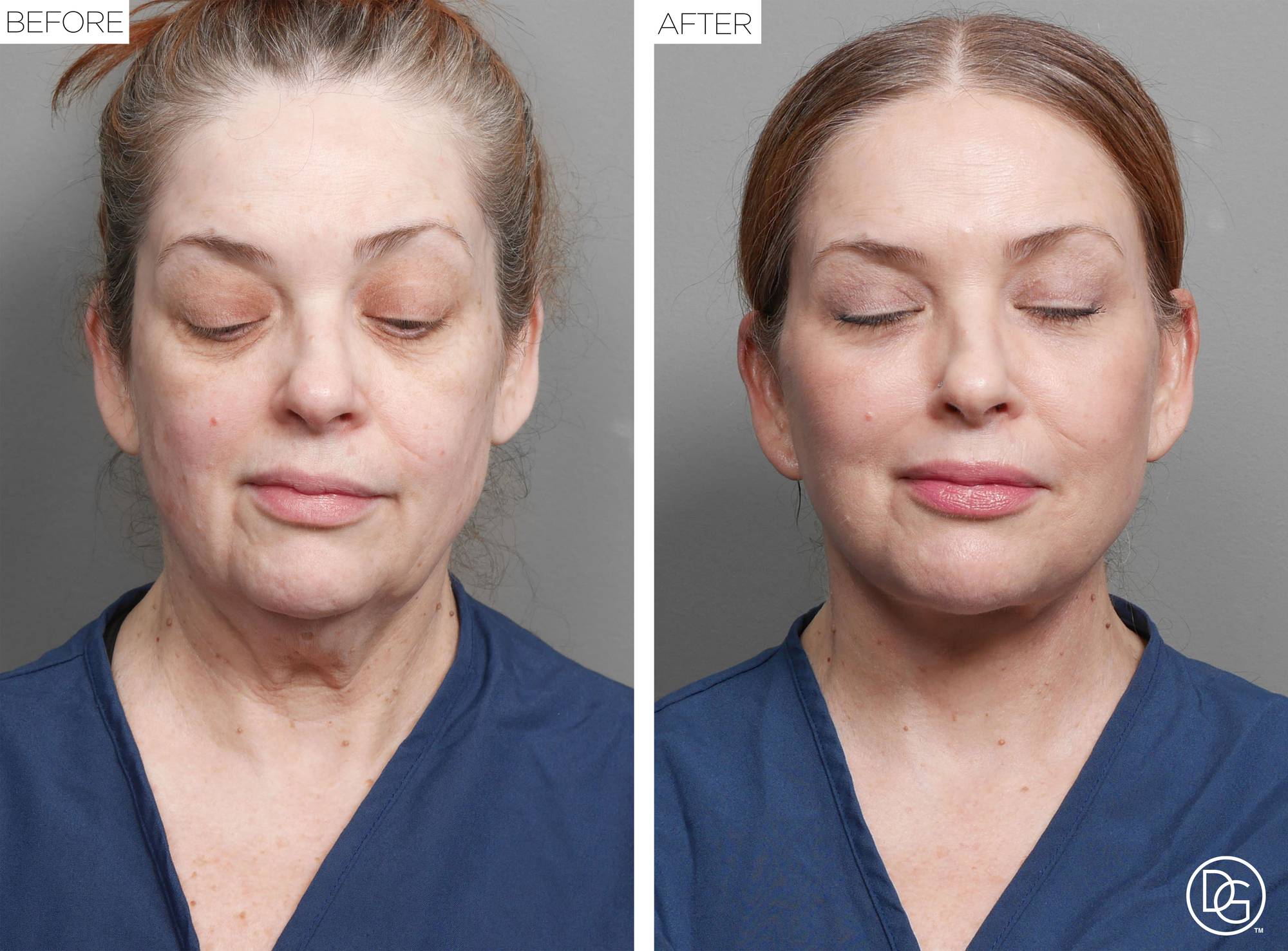 Before & After Image