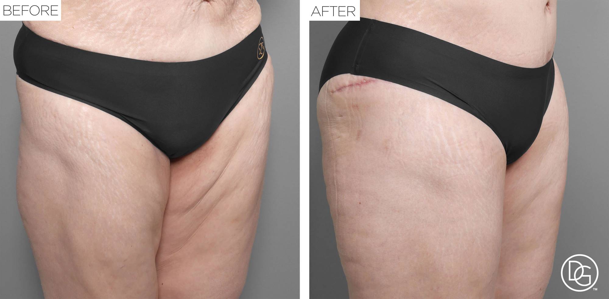 Before & After Image