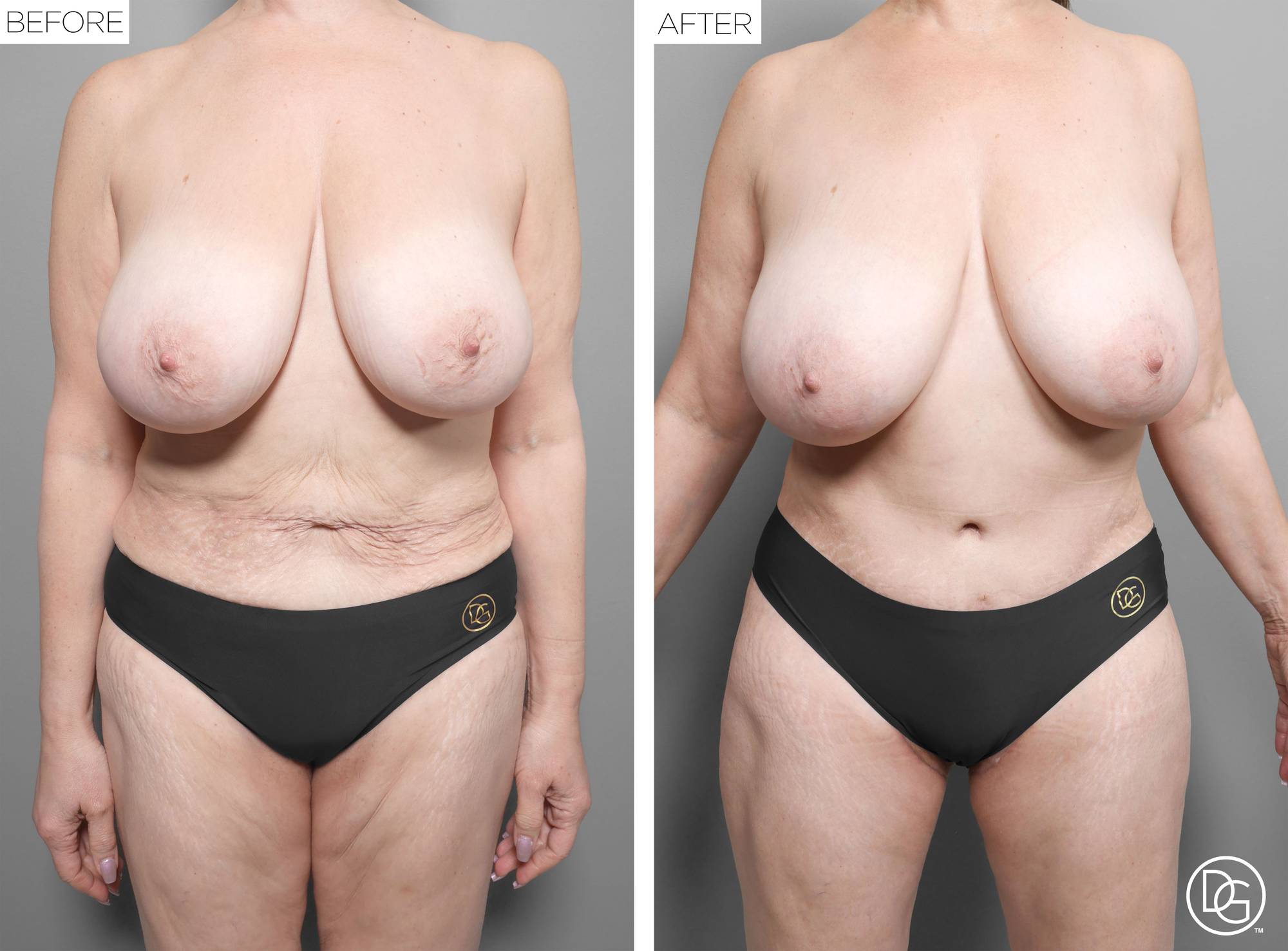 Before & After Image