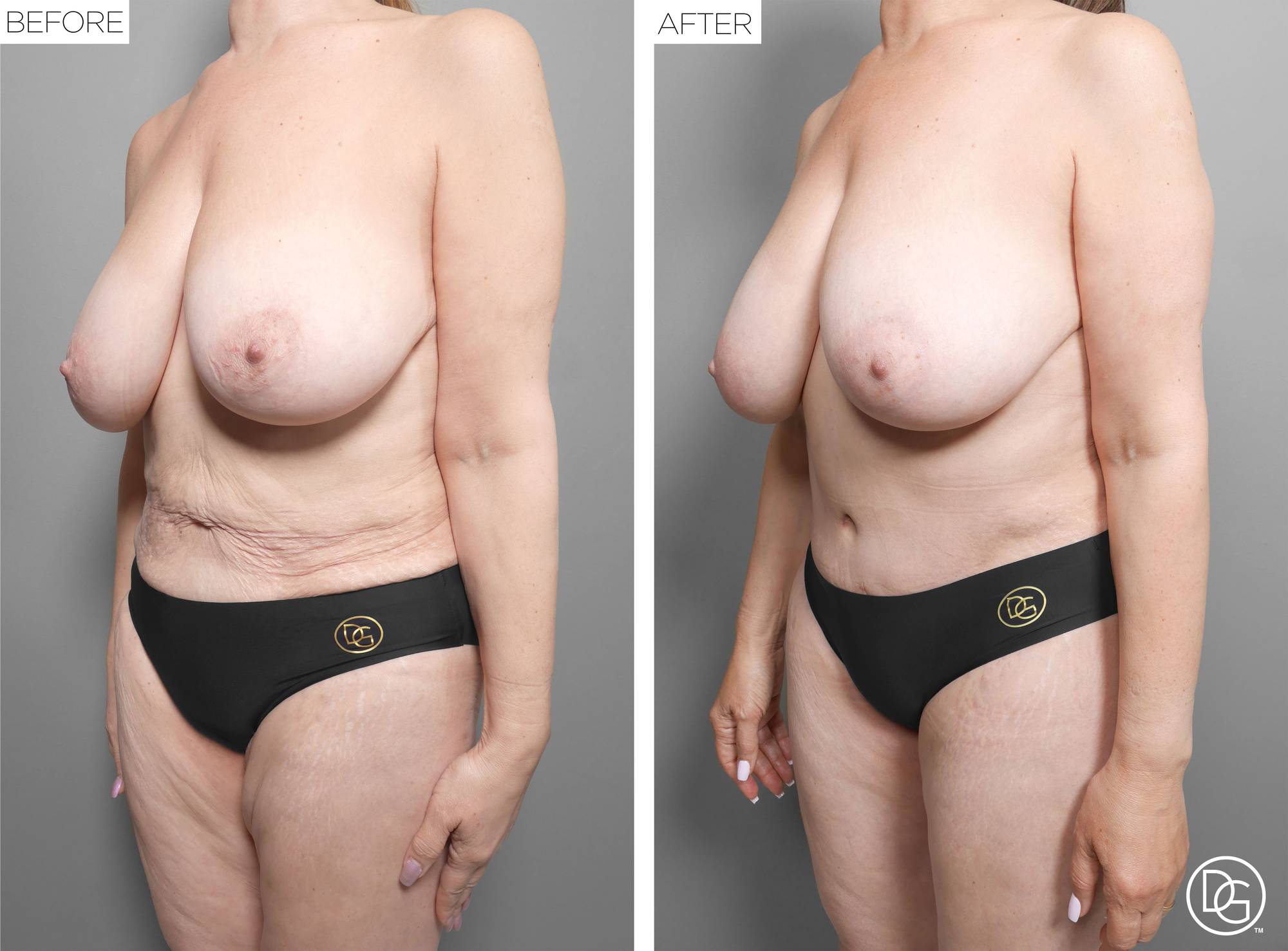 Before & After Image