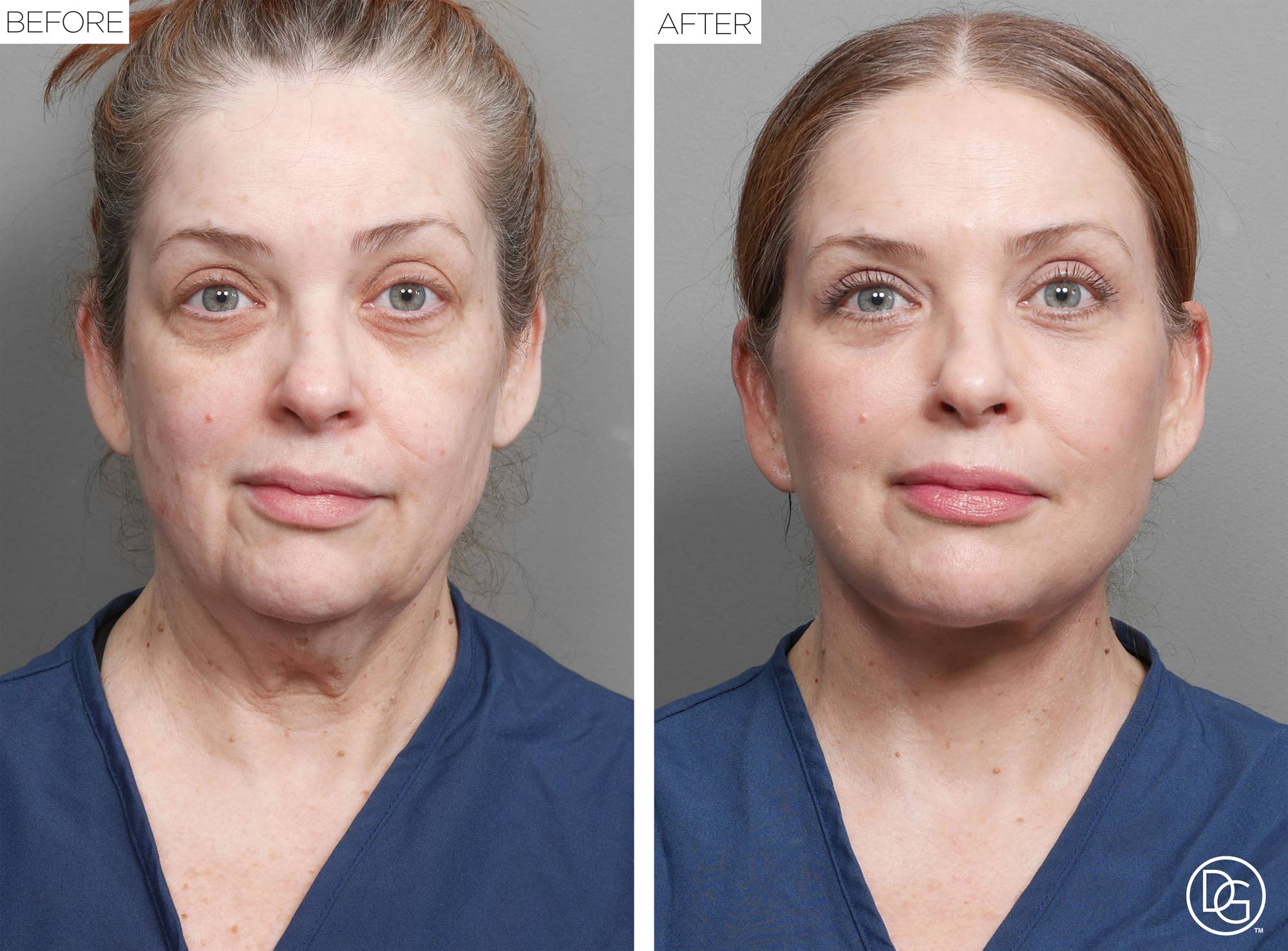 Before & After Image