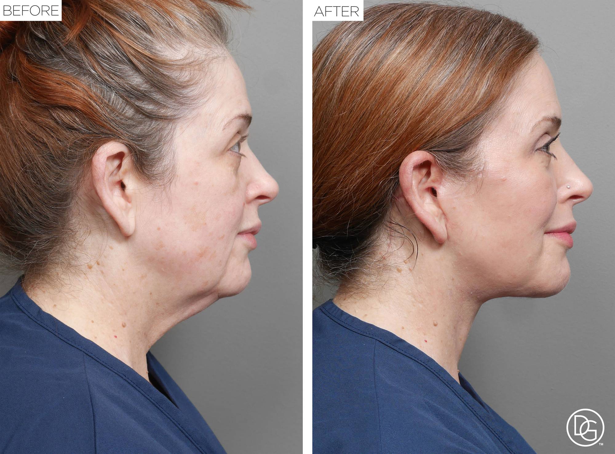Before & After Image