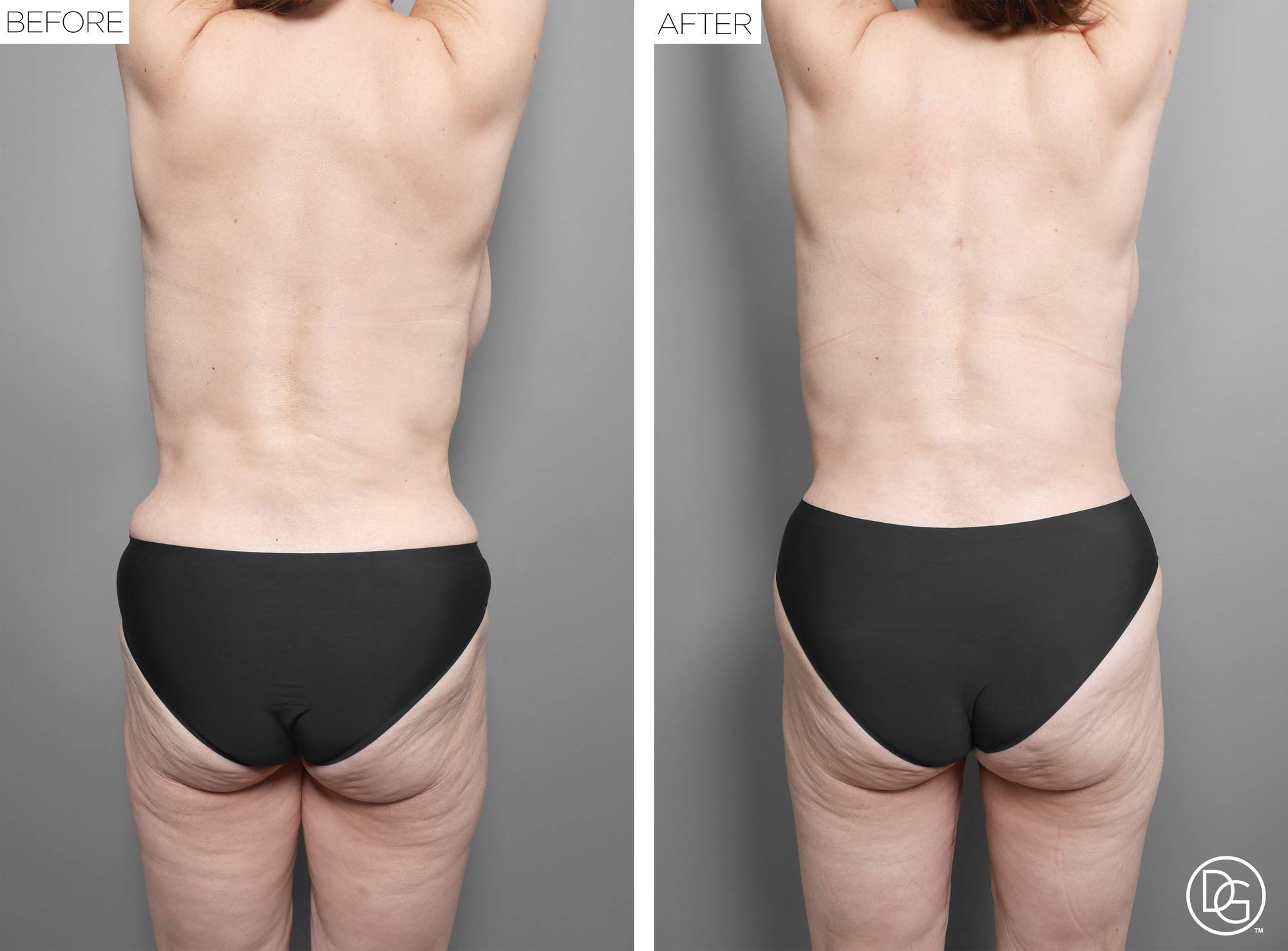 Before & After Image