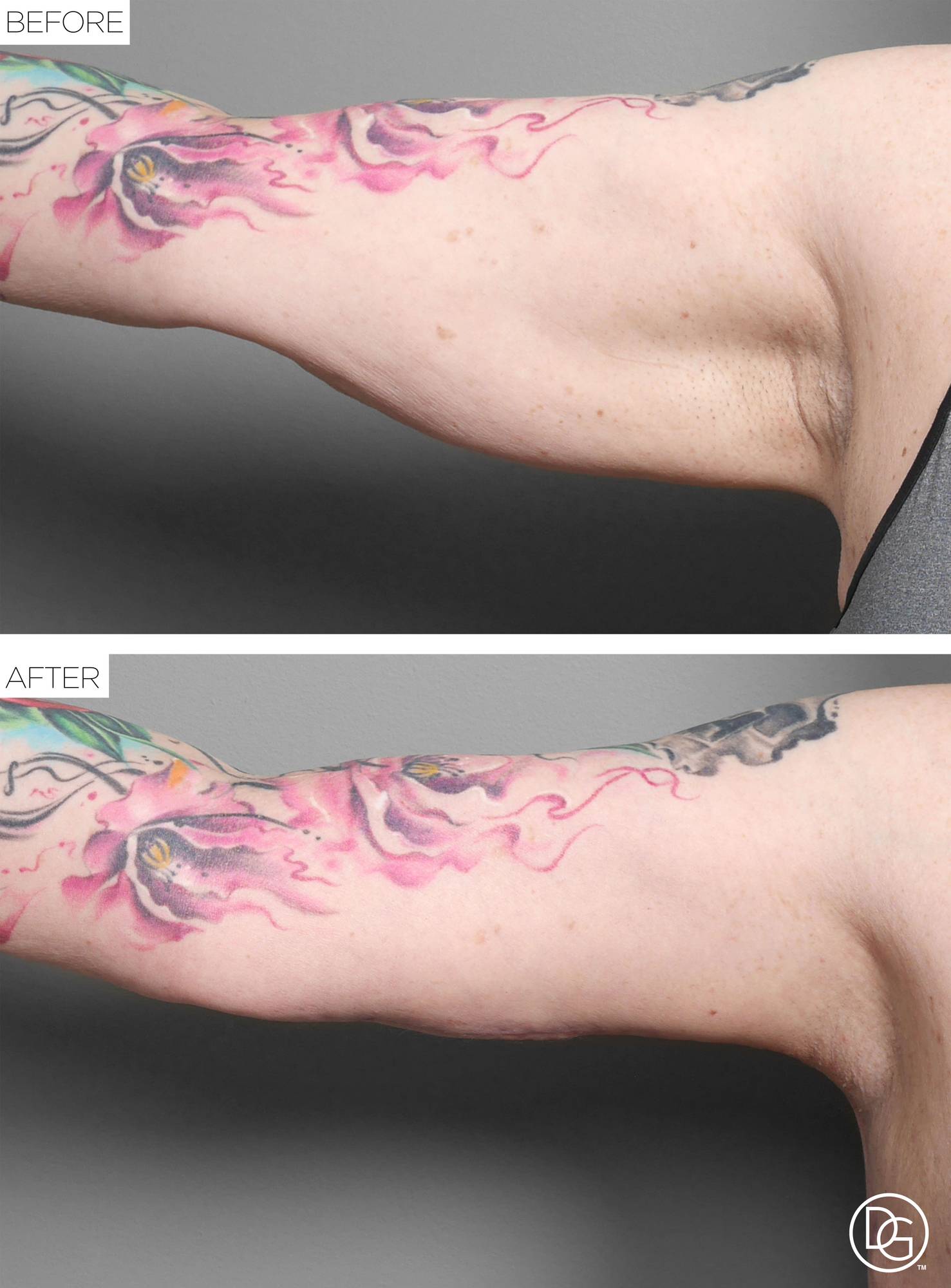 Before & After Image