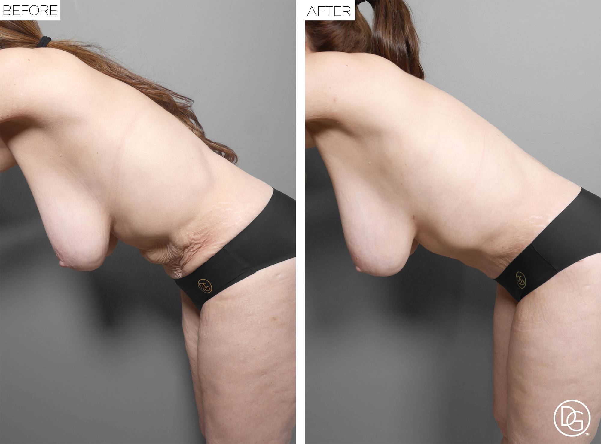 Before & After Image
