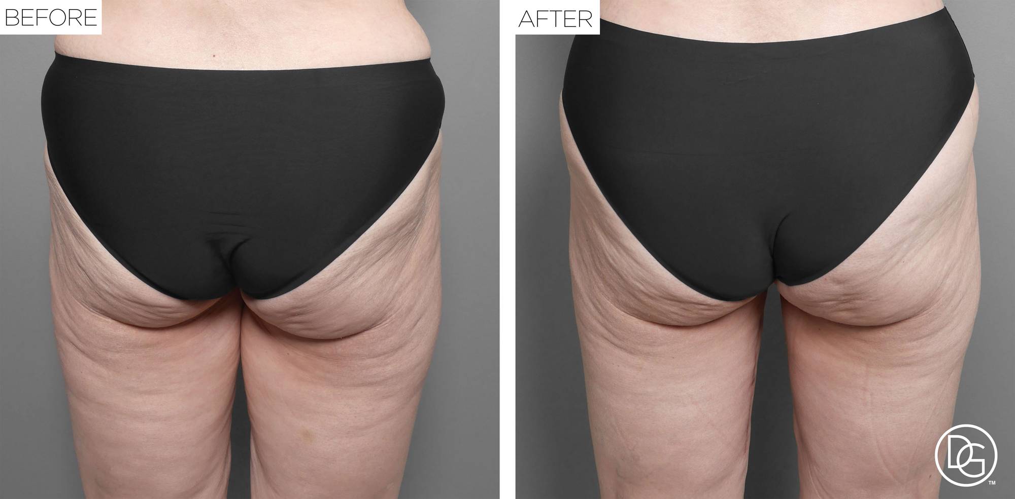 Before & After Image