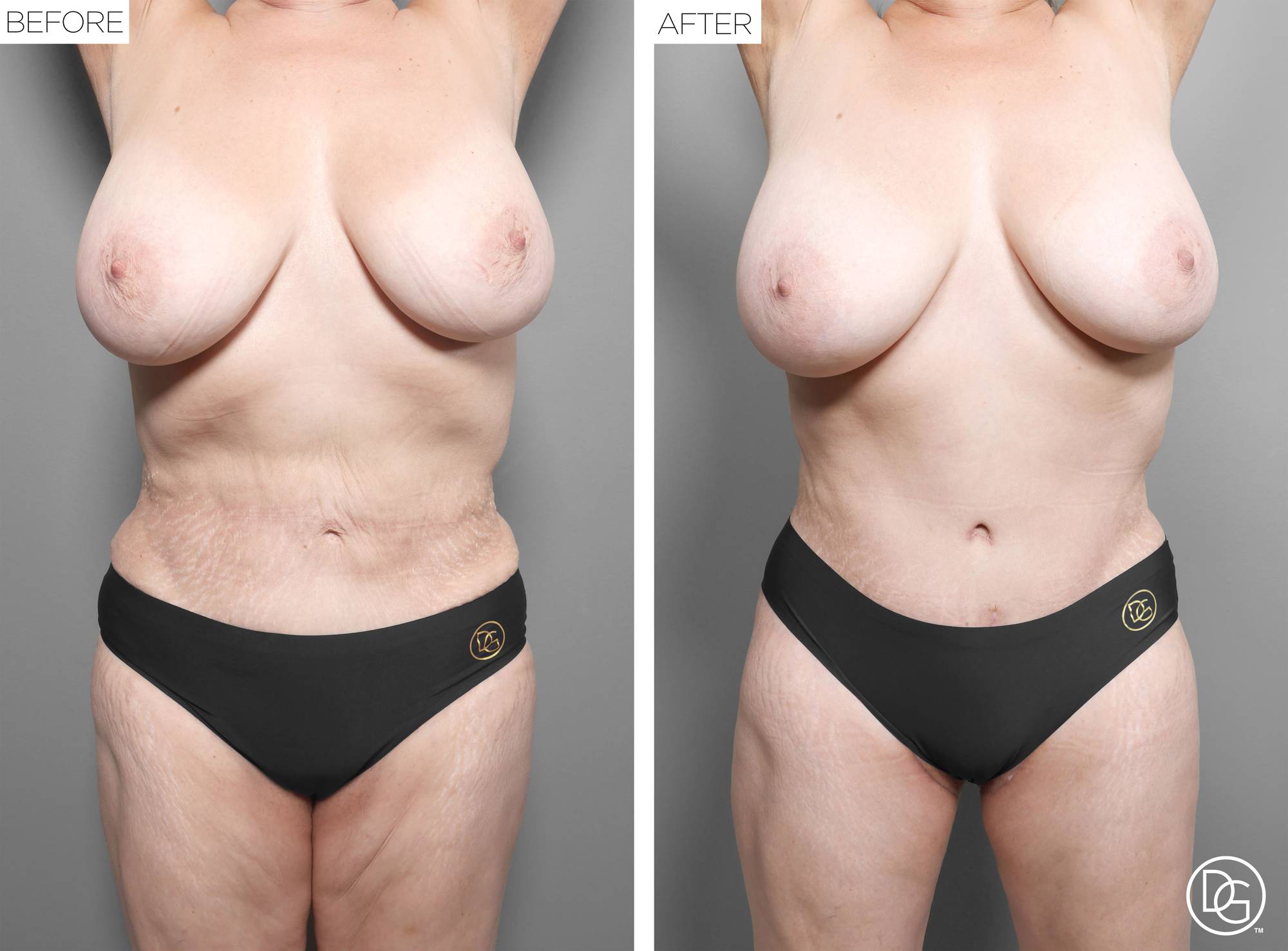 Before & After Image