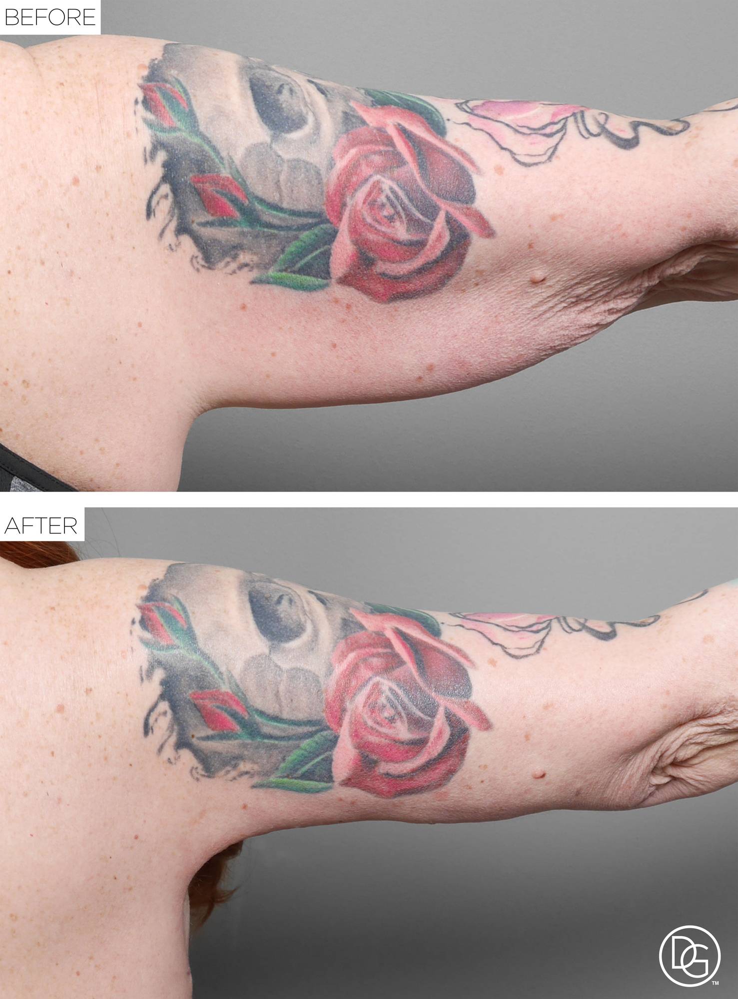 Before & After Image