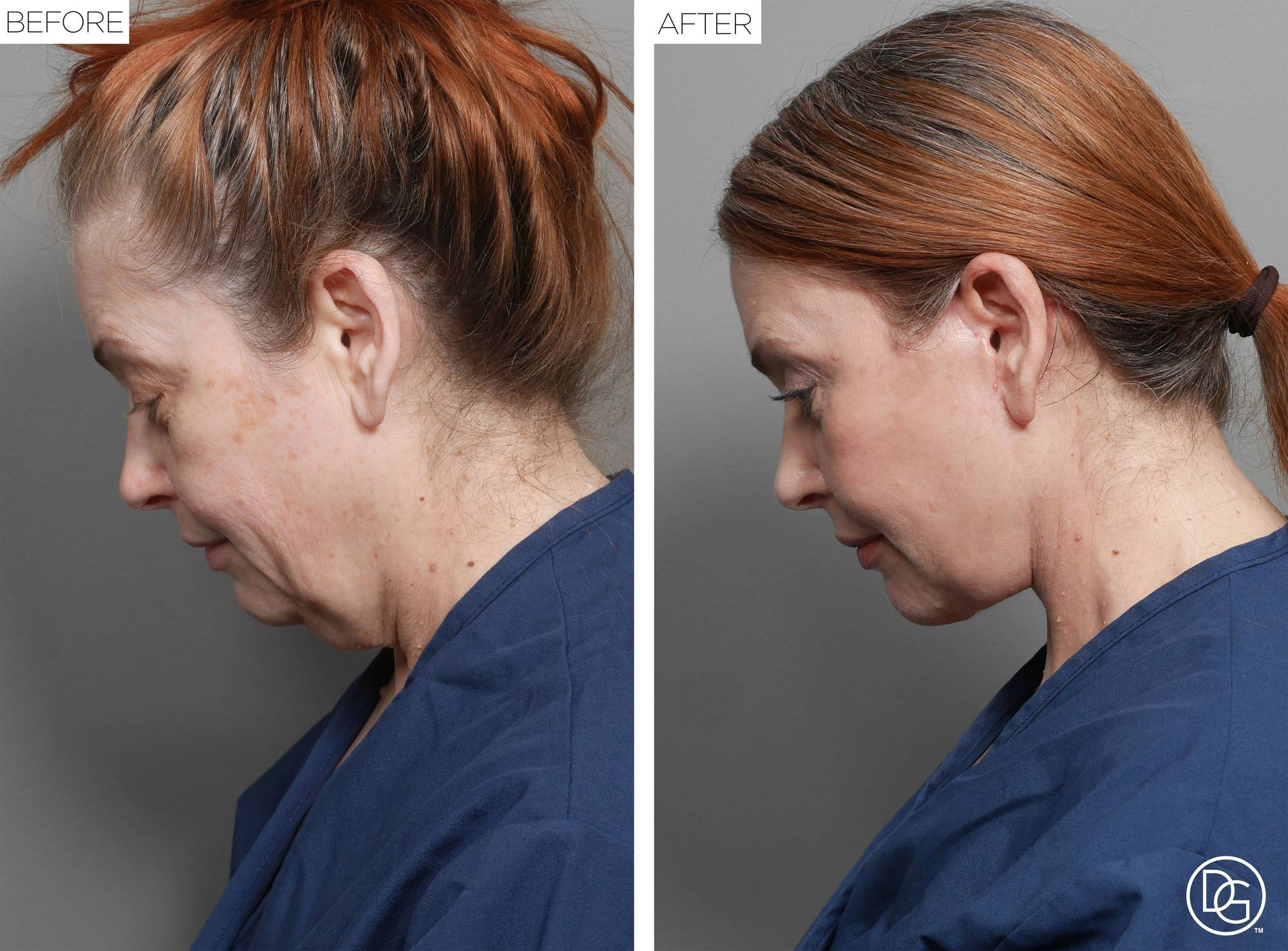 Before & After Image
