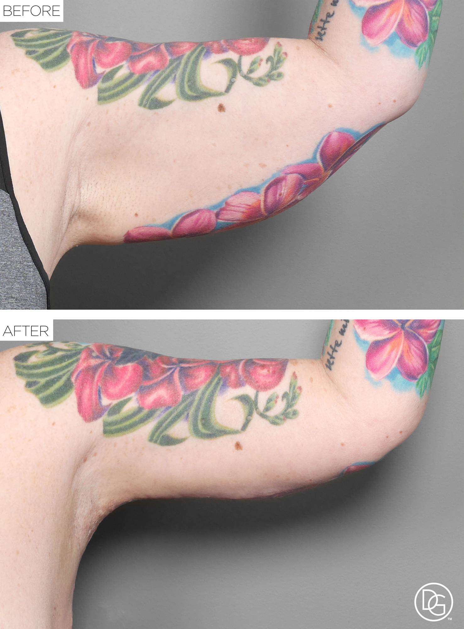 Before & After Image