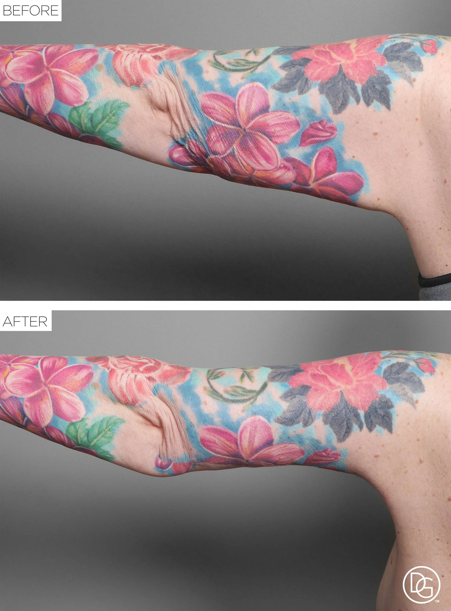 Before & After Image