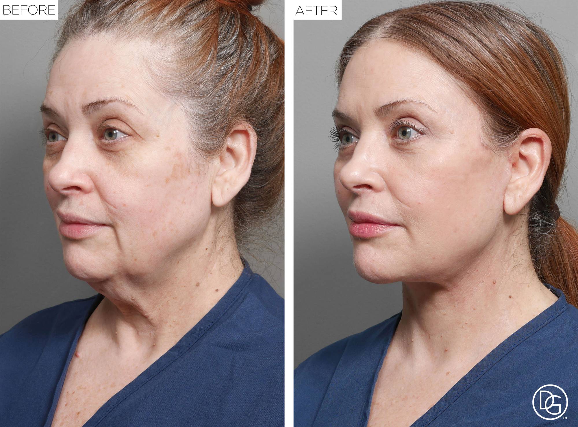 Before & After Image