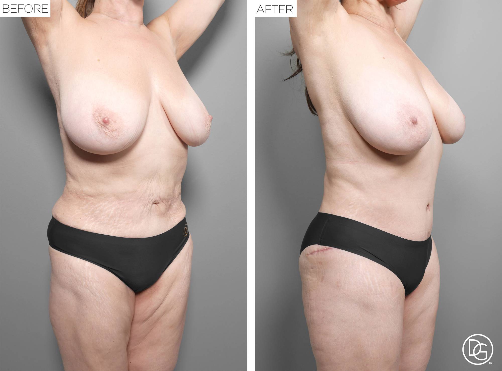 Before & After Image
