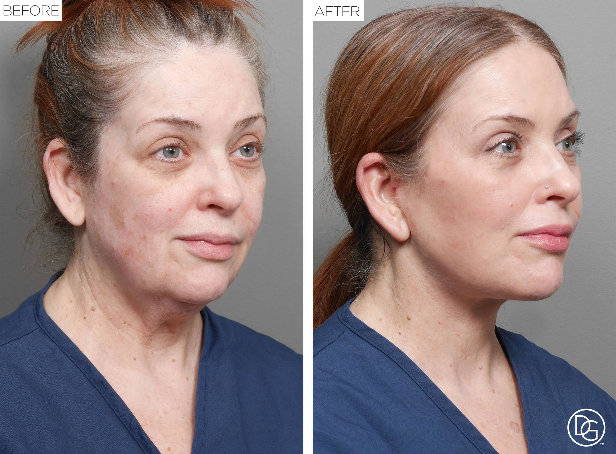 Before & After Image