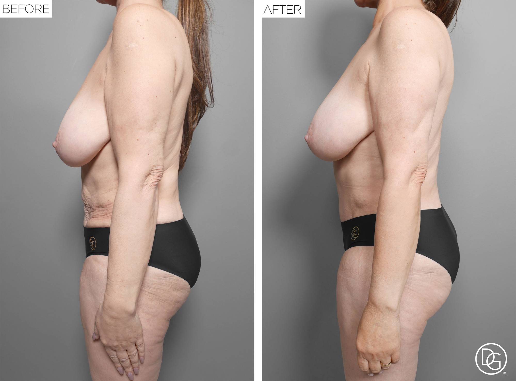 Before & After Image
