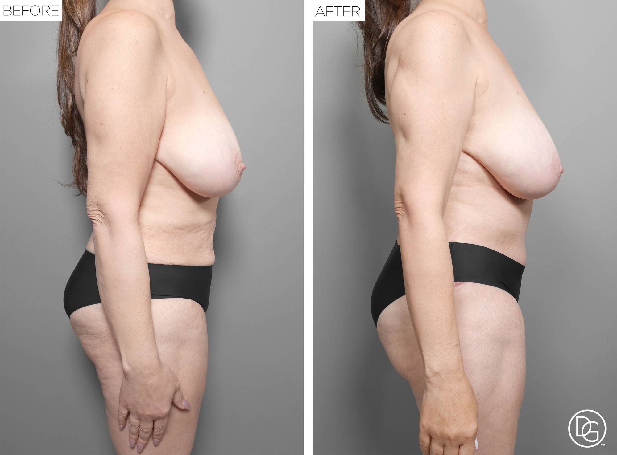 Before & After Image