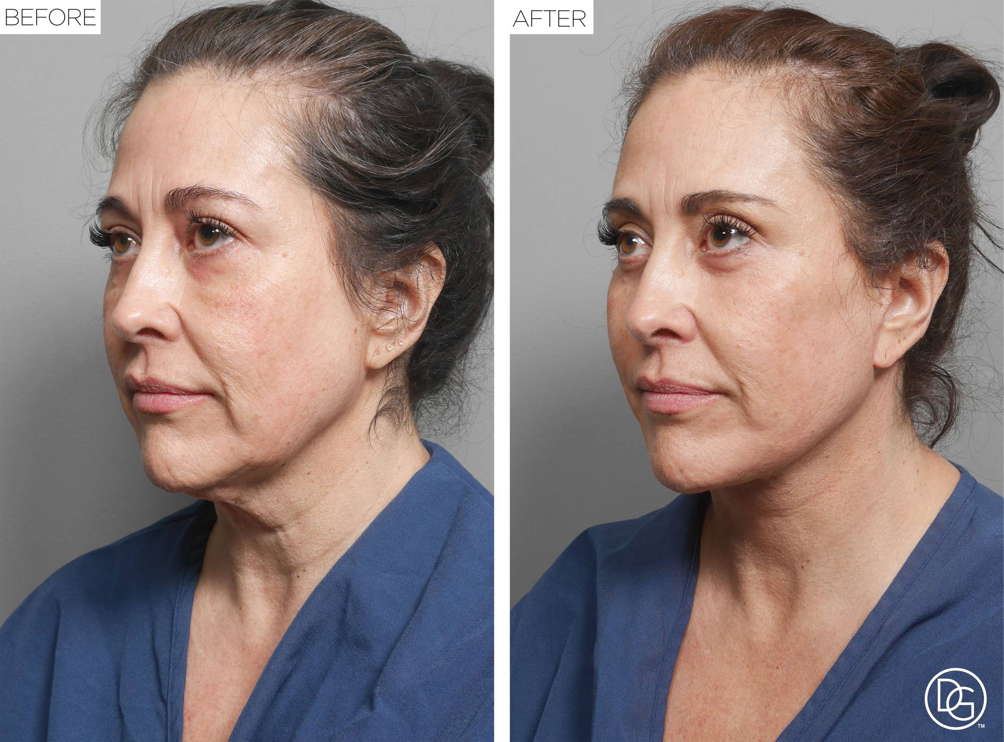 Before & After Image