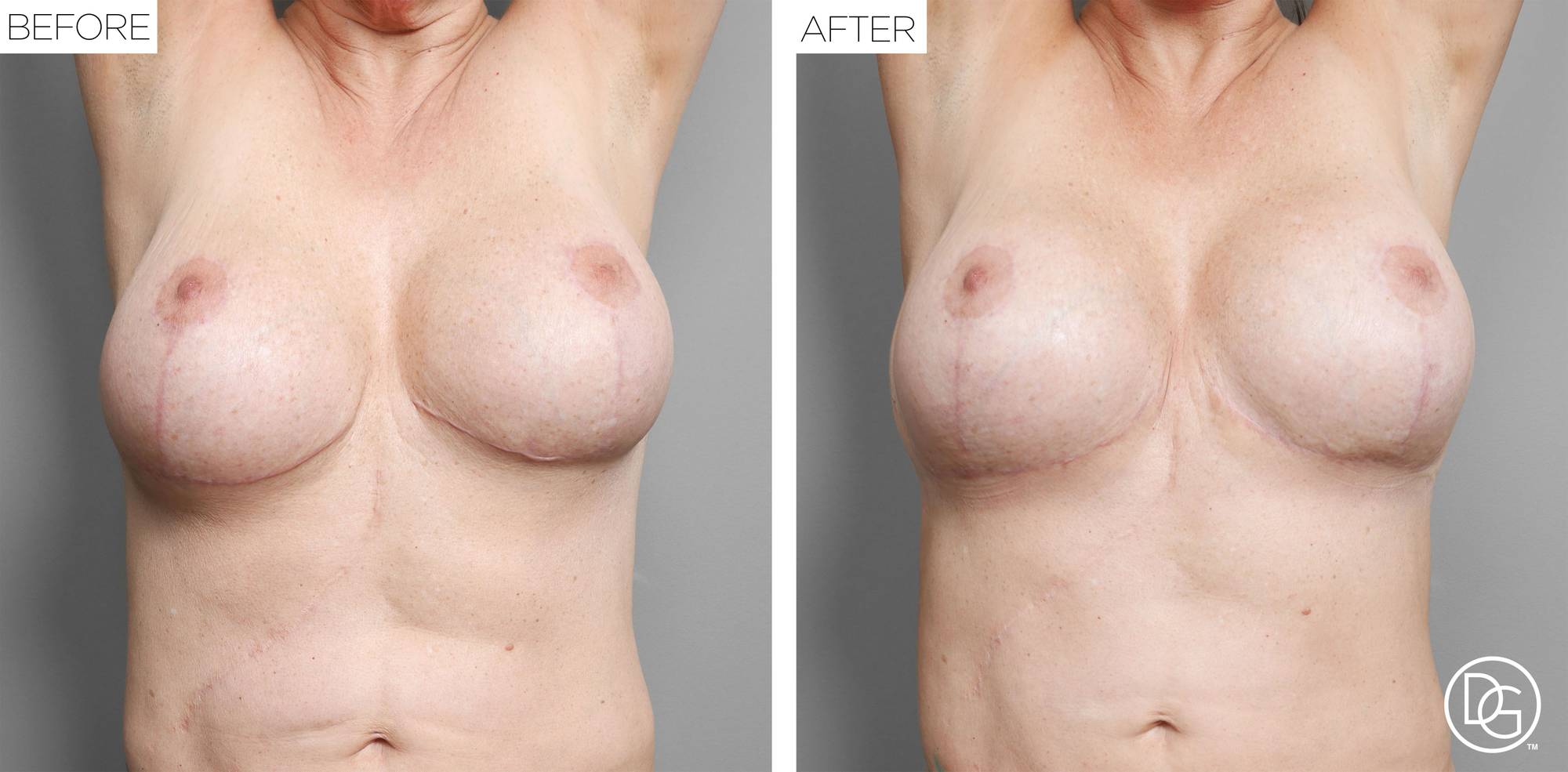 Before & After Image